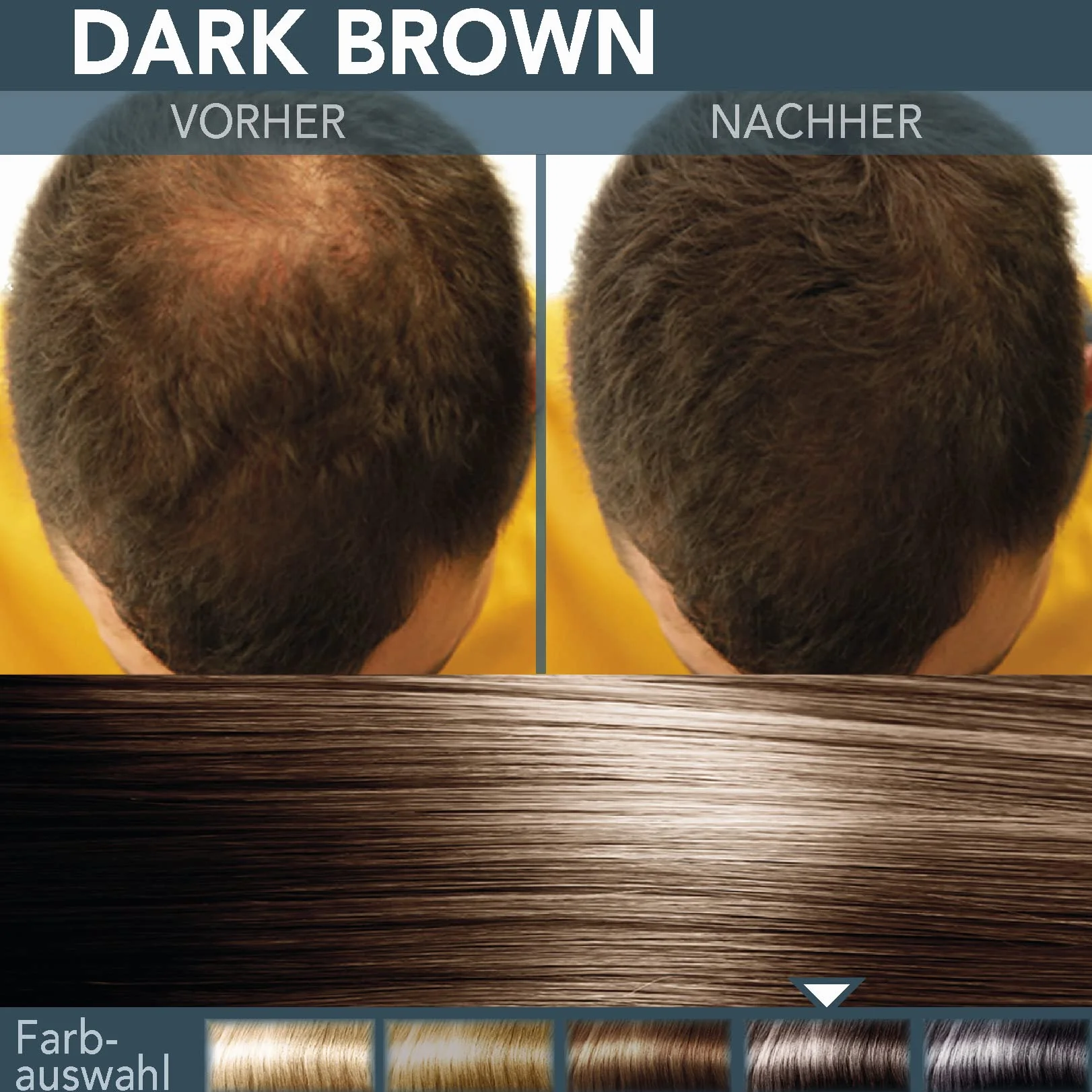 COVER HAIR - Premium włosy do zagęszczania włosów 14 g, autentyczny wygląd dla mężczyzn i kobiet, 100% naturalny ciemny brąz, 14 g