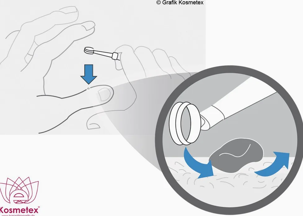 Kureta do skóry, ostre łyżeczki Kai do łyżeczkowania, Kosmetex Hautcuretten, Curette, zestaw 10 miksów