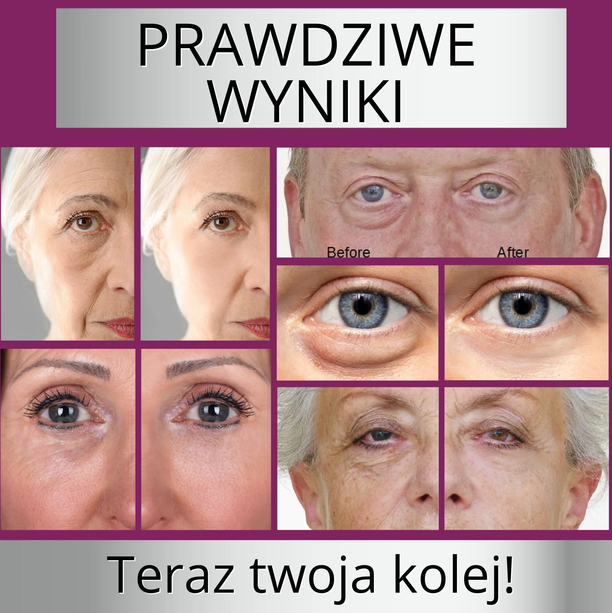 DERMAWORKS Immaculift Face Lifting Serum – Serum do Twarzy o Natychmiastowym Efekcie Liftingu, Przeciwzmarszczkowa Pielęgnacja pod Oczy dla Kobiet – Nowa i Ulepszona Formuła, 20 ml