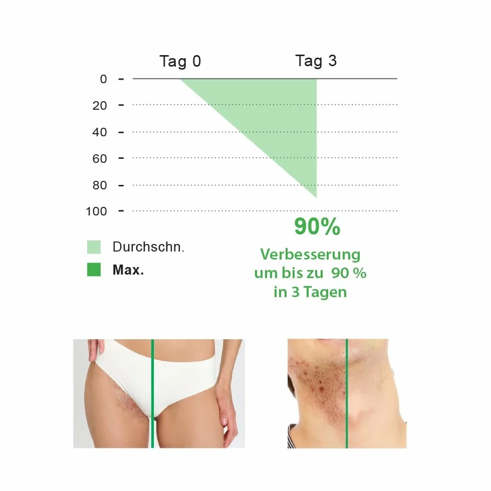 BioMD Przeciw wrastającym włoskom, z kwasami BHA i AHA, podrażnienia po goleniu, golenie, woskowanie, prevents ingrown hairs, Razor Burn, Shaving, Waxing, Vegan - 90ml