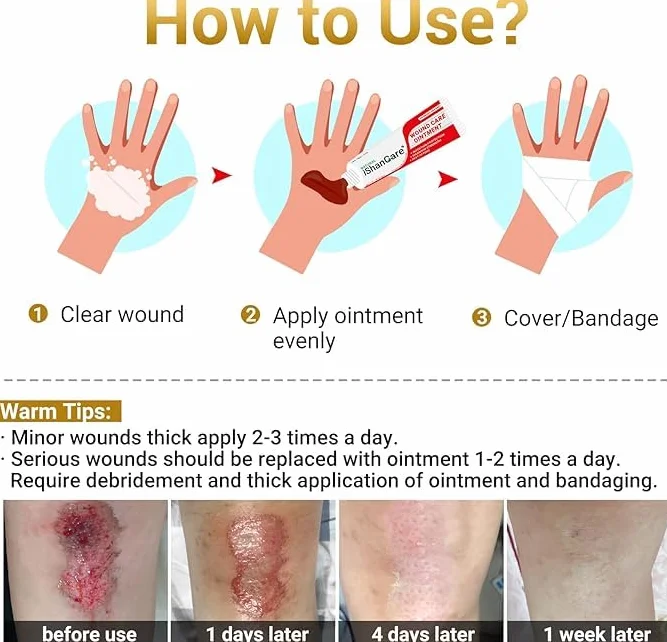 iShanCare® Wound Care Ointment - Maść pierwszej pomocy, 3X szybsze gojenie oparzeń, wrzodów, skaleczeń, otarć, odleżyn, odleżyn, ran nóg i stóp, naturalna maść gojąca rany