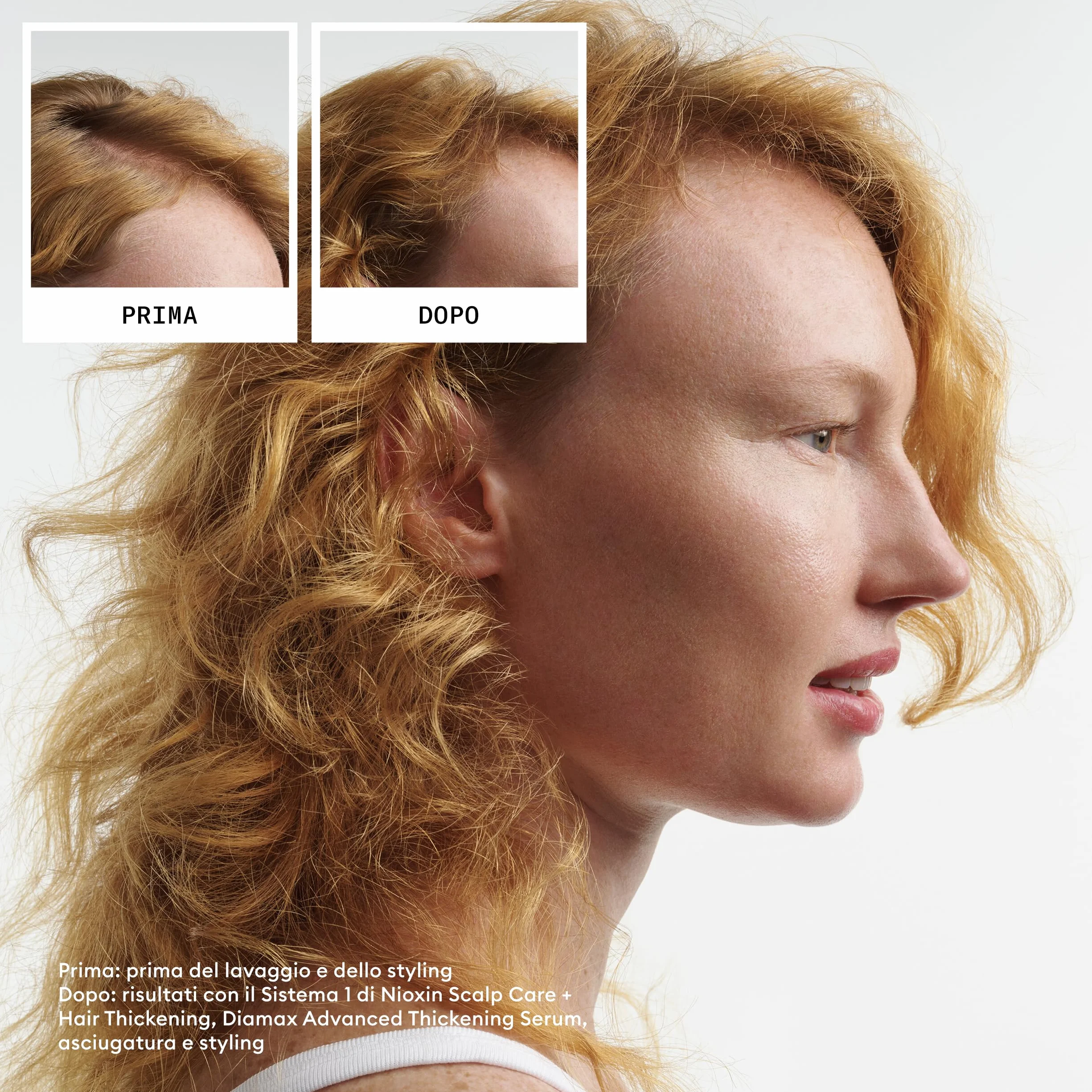 Nioxin Scalp + system zagęszczania włosów, 1 zestaw do trefazy - do włosów naturalnych z łagodnym przerzedzaniem - szampon, odżywka i pielęgnacja skóry głowy (300 + 300 + 100 ml)