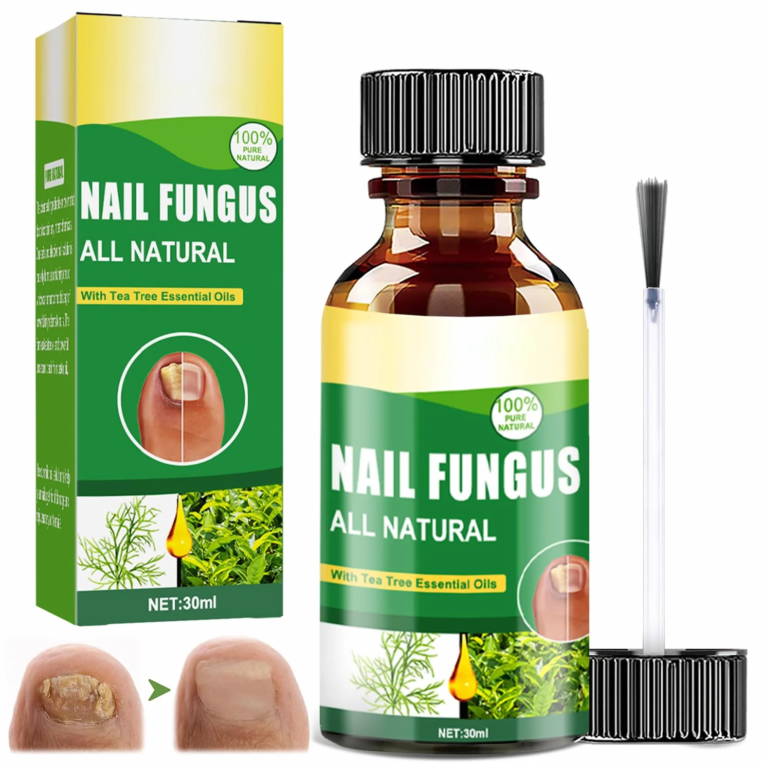 30ML Pielęgnacja Paznokci Stop,Nail Repair Solution,Pielęgnacja Uszkodzonych Paznokci,Nadaje się do Palec I Pedicure Professional Care,Naprawy i Zapobieganie Nail
