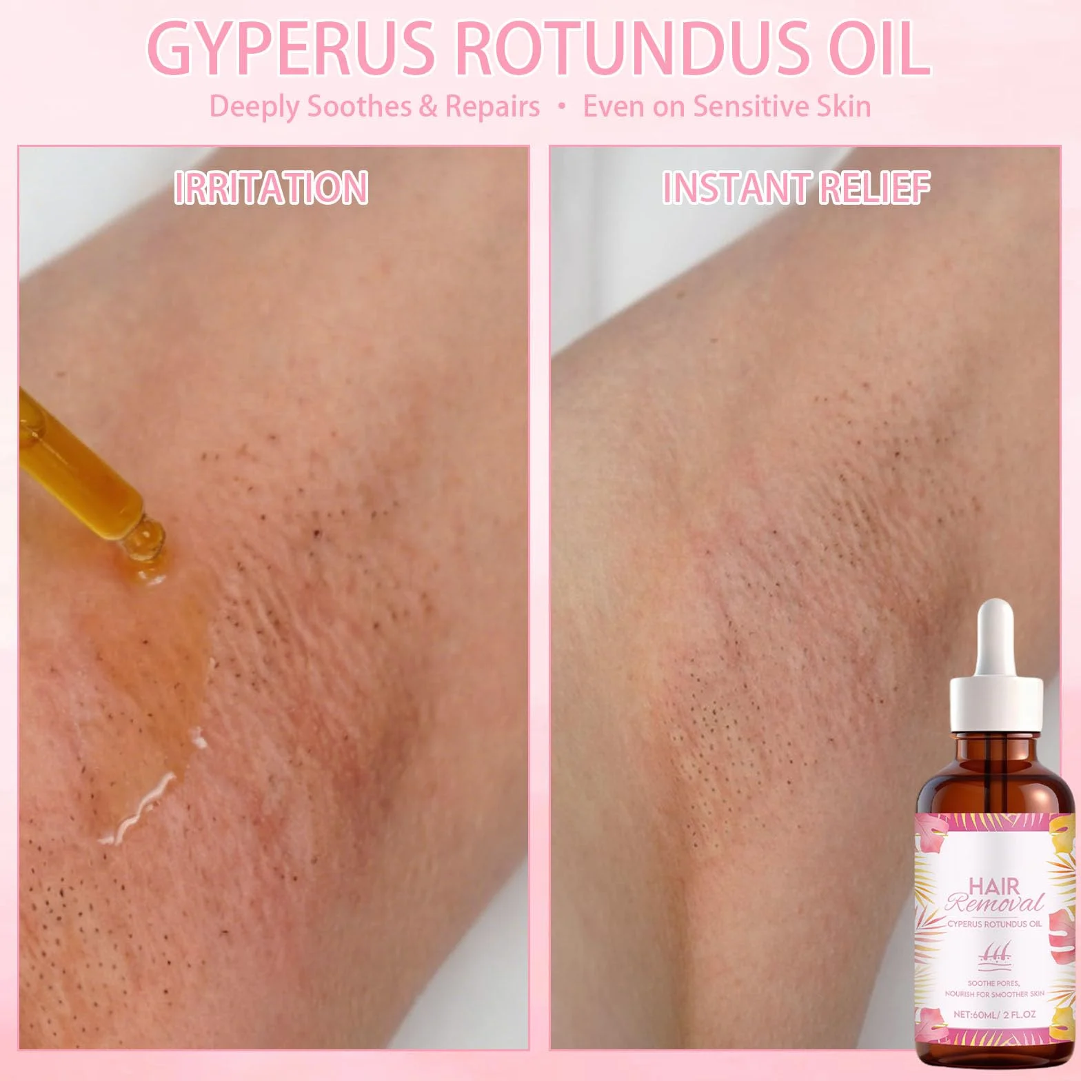 Cyperus Rotundus Oil, 2 butelki z olejkiem Cyperus Rotundus, olejek Rotundus, hamuje wzrost włosów na ciele, nawilża i koi skórę, w zestawie 1 golarka