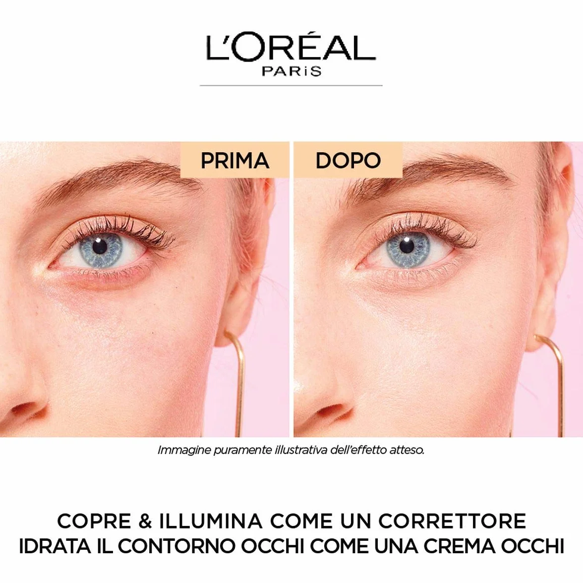 L'Oréal París Accord corrector Parfait Eye Cream in a Concealer tono medio claro 3-5.5R Peach