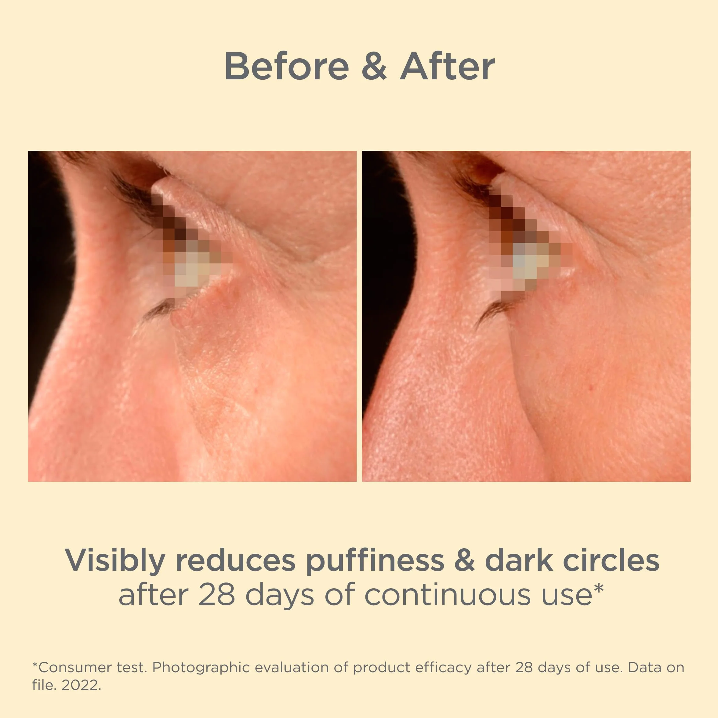 Isdin Isdinceutics K-Ox Eyes 15ml