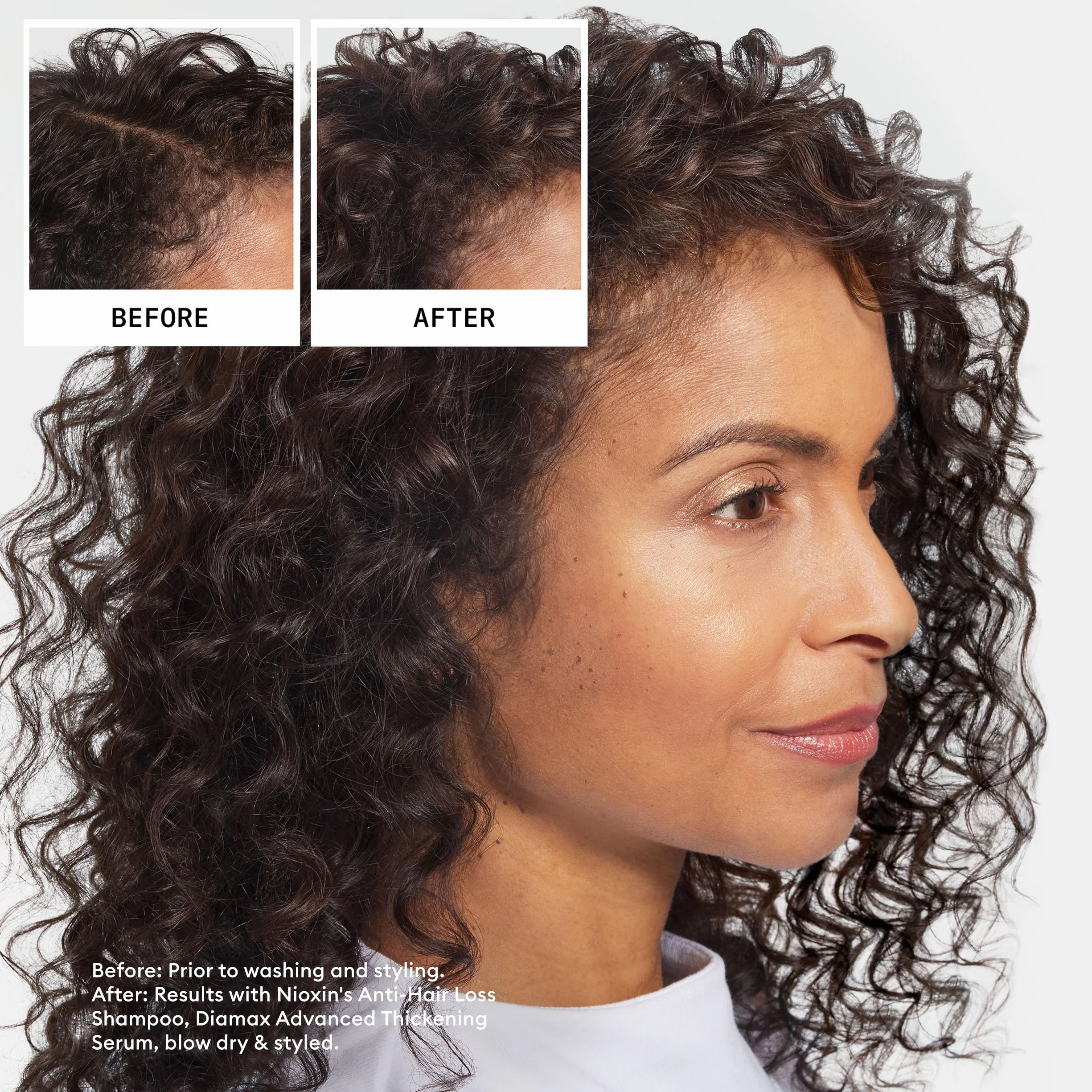 Nioxin Anti Hair Loss Shampoo 240ml - Shampoo Anticaduta