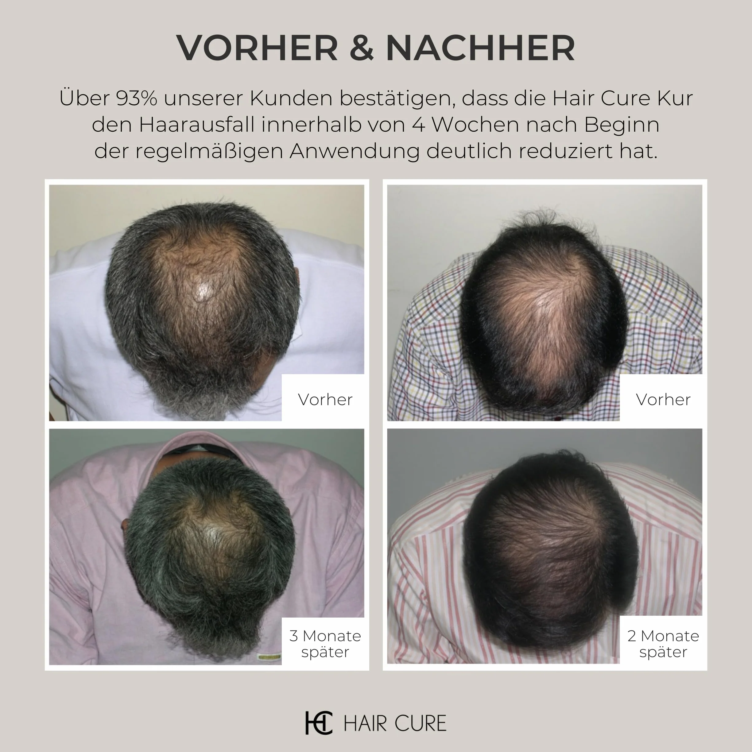HAIR CURE Odżywcze Serum Przeciw Wypadaniu Włosów 150 ml - Ultramocna Kuracja Hamująca Łysienie - 16 Nanocząsteczkowe Składniki Aktywne i 3 peptydy biomimetyczne