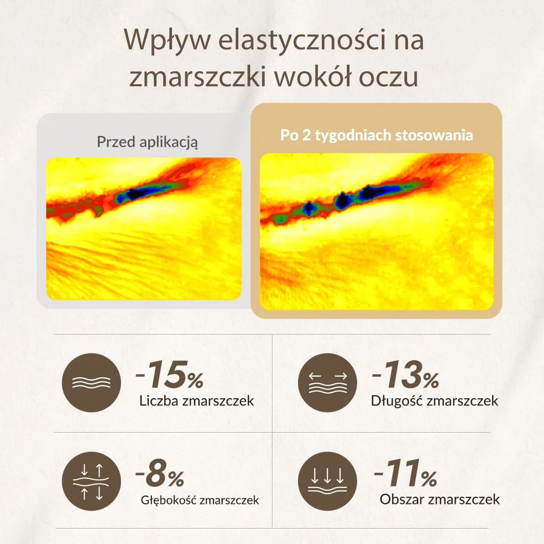 MIZON Krem do paznokci do oczu 15 ml Korean Skincare zabieg ciemnego okręgu regeneracja skóry krem nawilżający