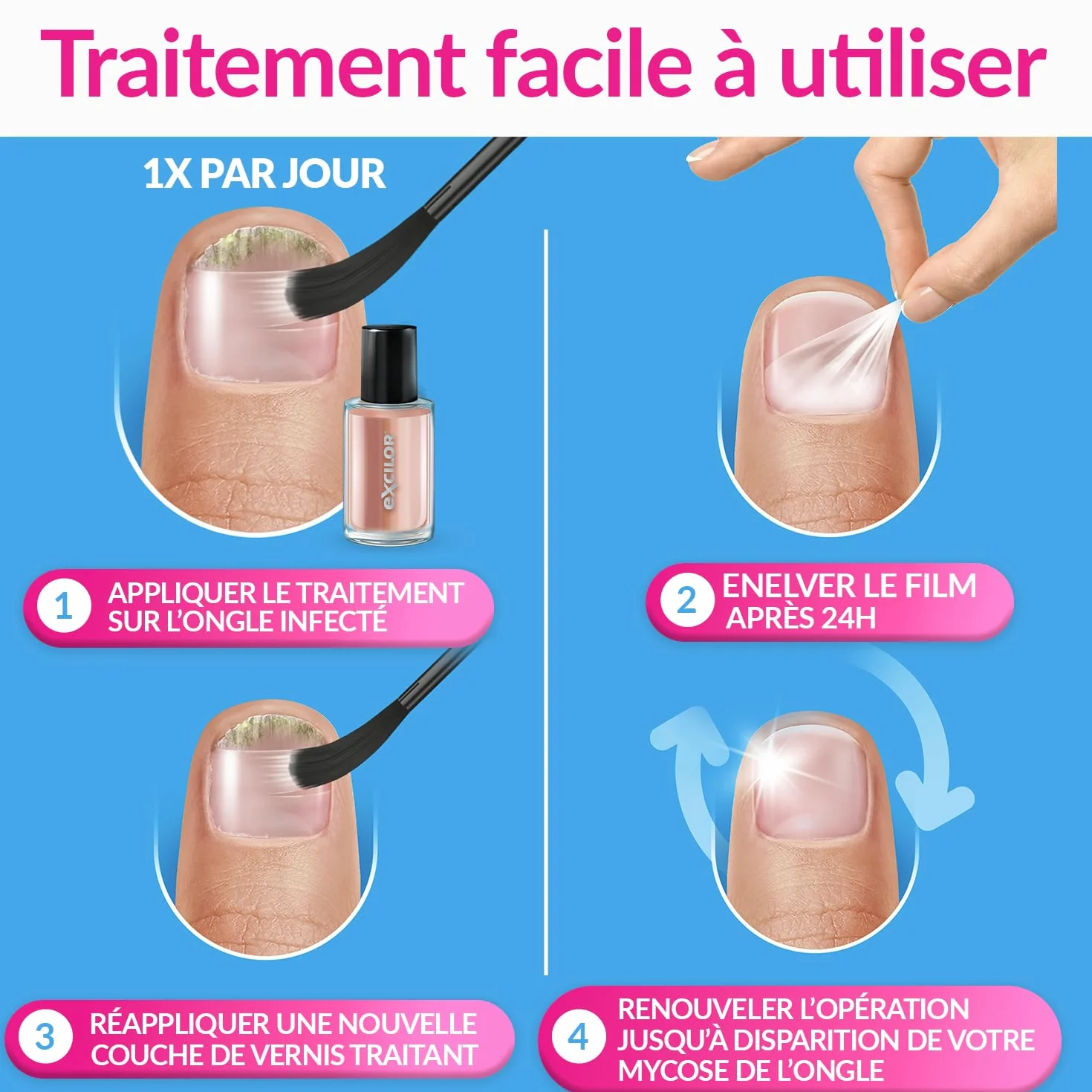 EXCILOR - Forte Color - Leczenie grzybicy paznokci - Dojenie i okładki - Zabieg 30ml + Kosmetyczny lakier do paznokci 8ml - Udowodnione klinicznie* - Nude