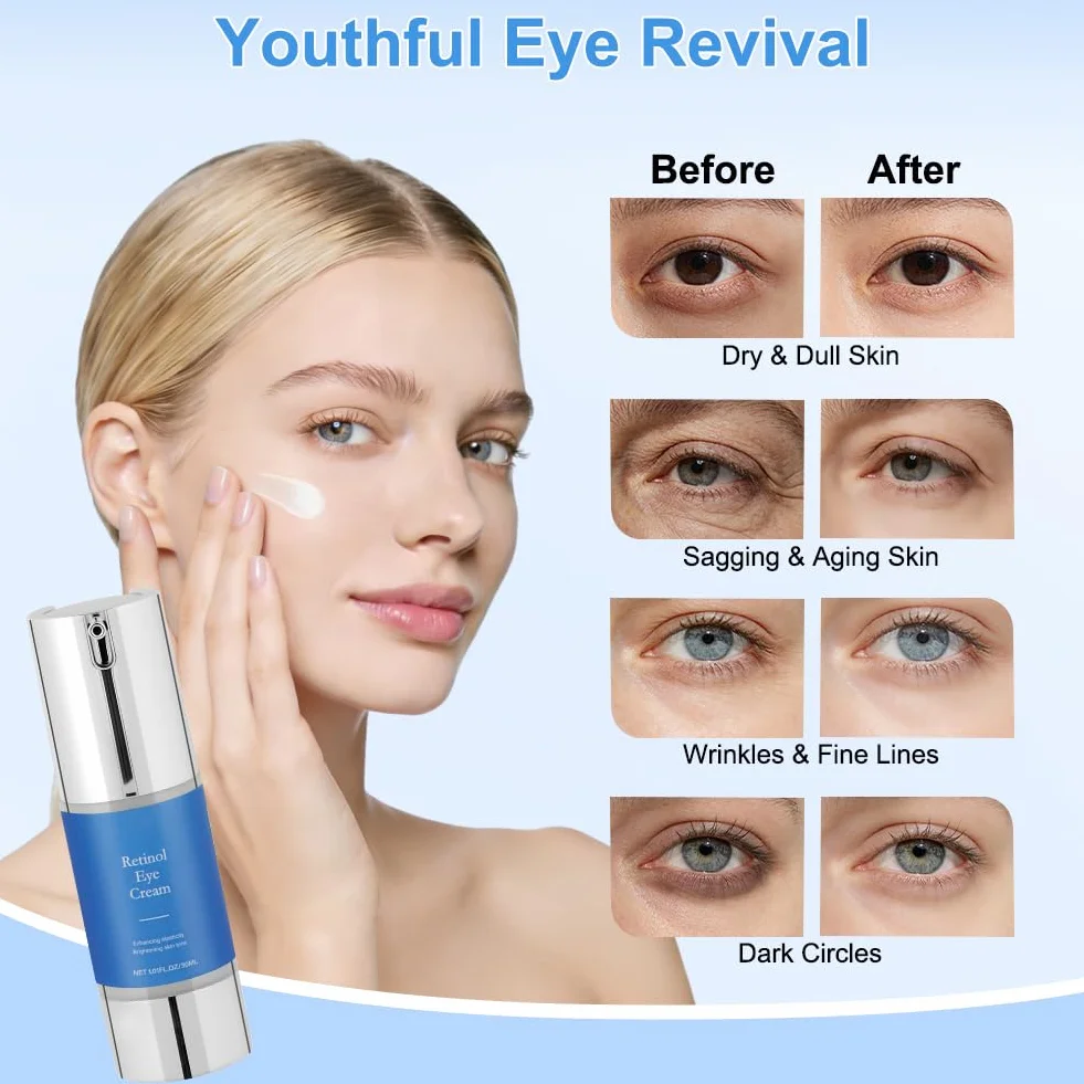 Aomig Retinol Krem pod oczy, 30 ml Krem przeciwzmarszczkowy i starzejący się do oczu z Bakuchiolem, Redukuje zmarszczki i drobne zmarszczki, zmniejsza obrzęki i cienie pod oczami, nawilżający