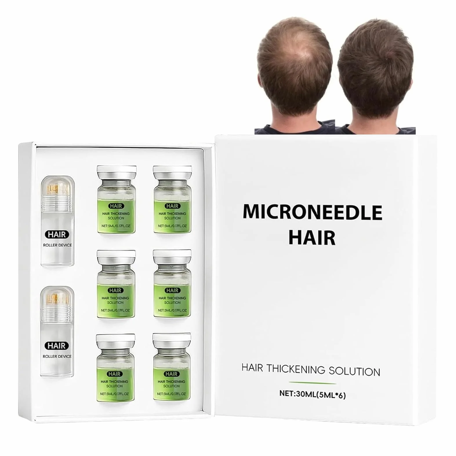 Microneedle Hair Regrowth System – system odrastania włosów, mikroinfuzja serum na wzrost włosów, wzmacnia cebulki włosów, wspomaga wzrost włosów, zapobiega wypadaniu włosów dla mężczyzn i kobiet