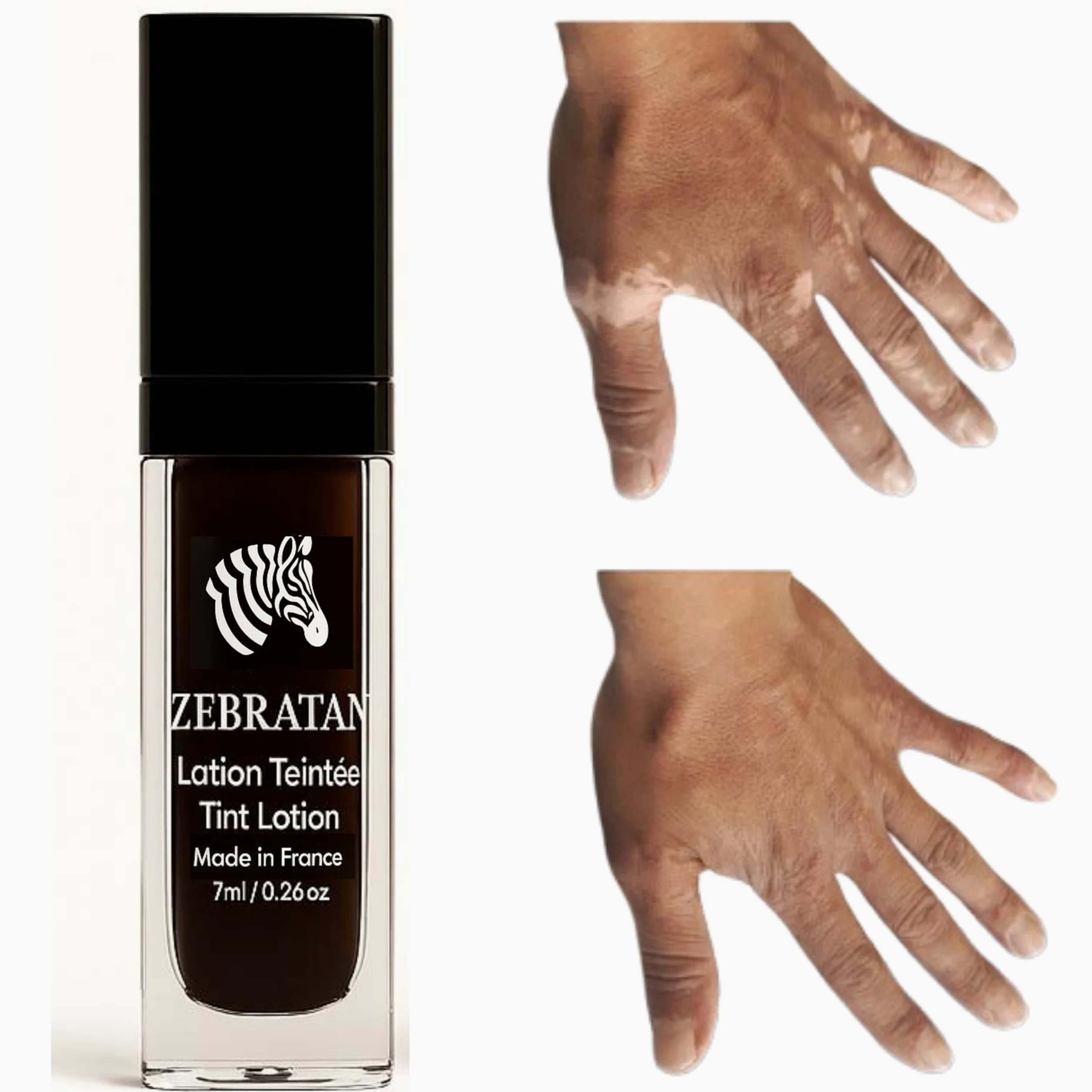 Lotion do makijażu bielactwa 7 ml – Maskuje białe plamy – Naturalny kamuflaż, wegański, głęboki brązowy odcień