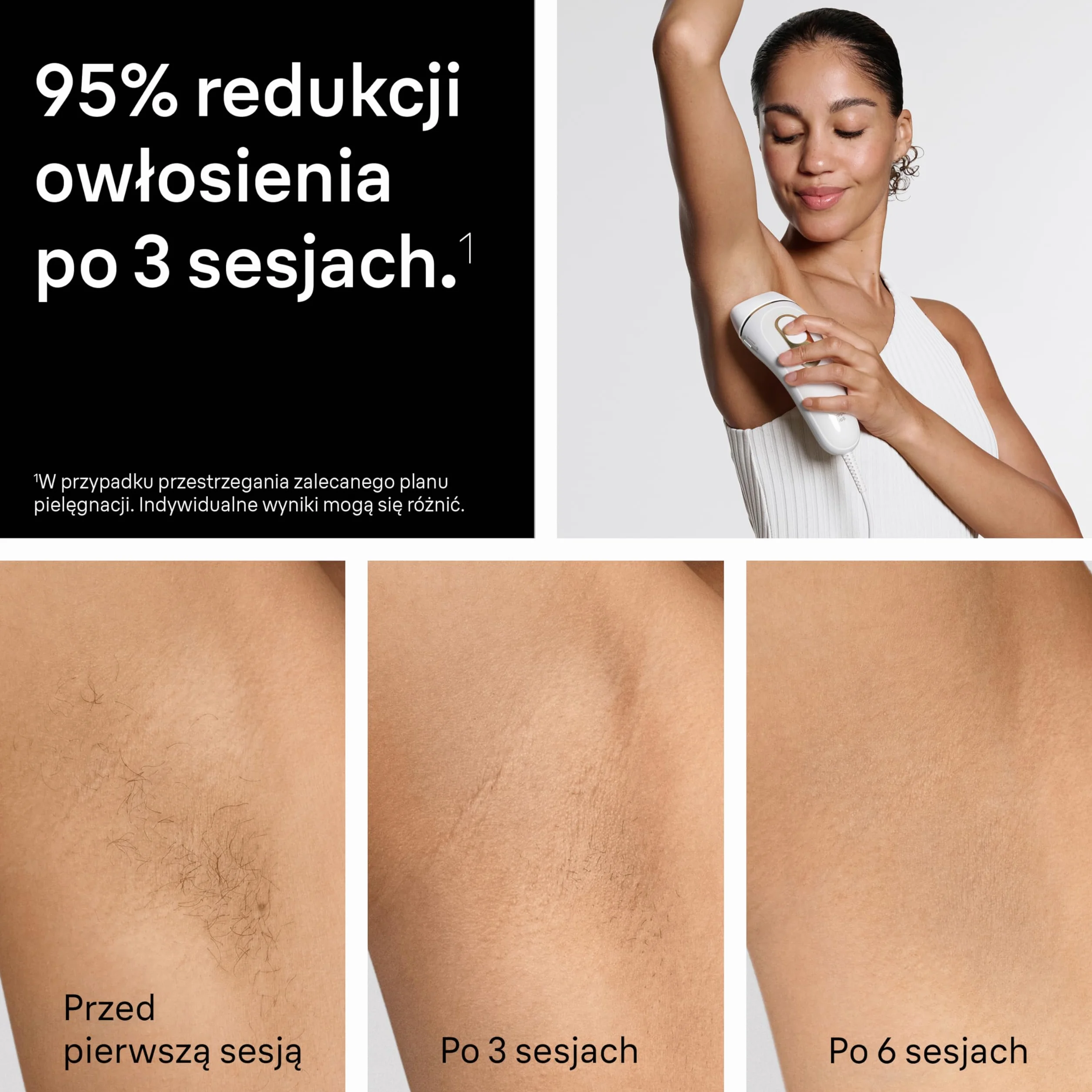 Braun IPL Smart Silk·expert Pro 5, Laserowe Usuwanie Owłosienia w Domu, Trwała Depilacja, Z Saszetką, Golarką Gillette Venus, 4 Nasadkami, PL5431