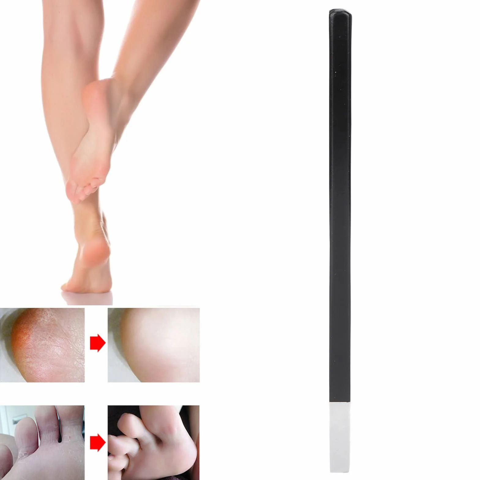 Nóż do Pedicure Narzędzia do Noża Wrastającego Paznokcia ze Stali Nierdzewnej Płaskie i Zaostrzone Ostrze Narzędzie do Usuwania Martwego Naskórka Narzędzie do Usuwania Paznokci z Pilnikiem do Paznokci