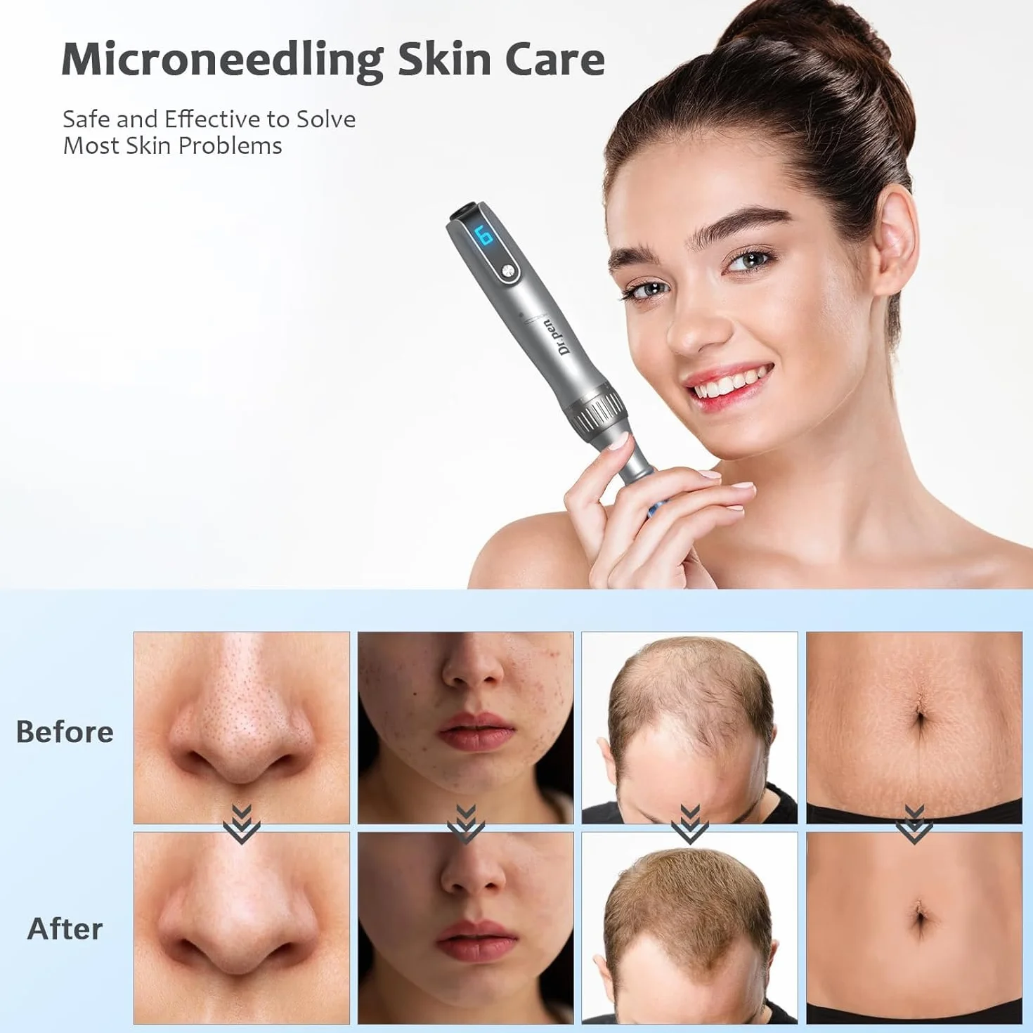 Dr. Pen Ultima M8S Bezprzewodowy Zestaw Derma Pen z 20 Kartridżami