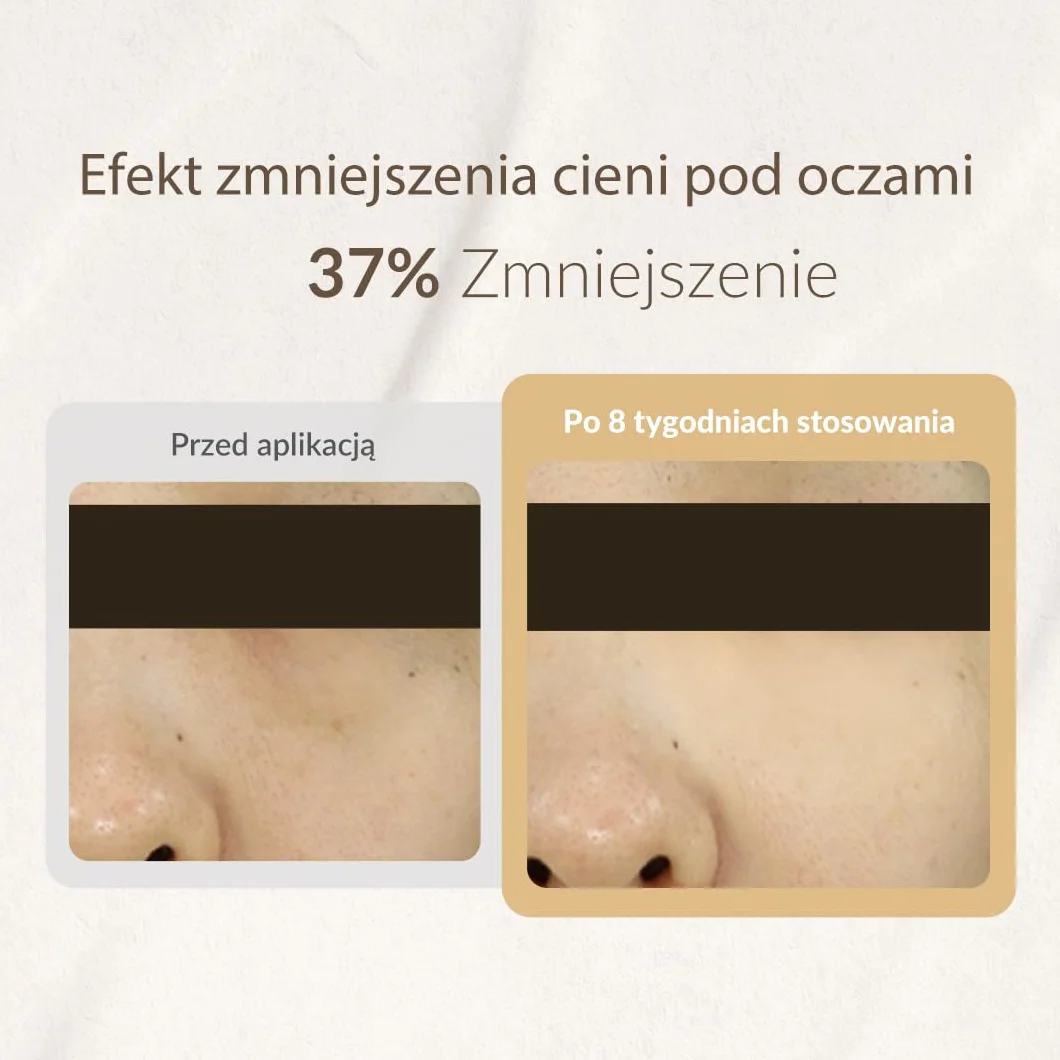 MIZON Krem do paznokci do oczu 15 ml Korean Skincare zabieg ciemnego okręgu regeneracja skóry krem nawilżający