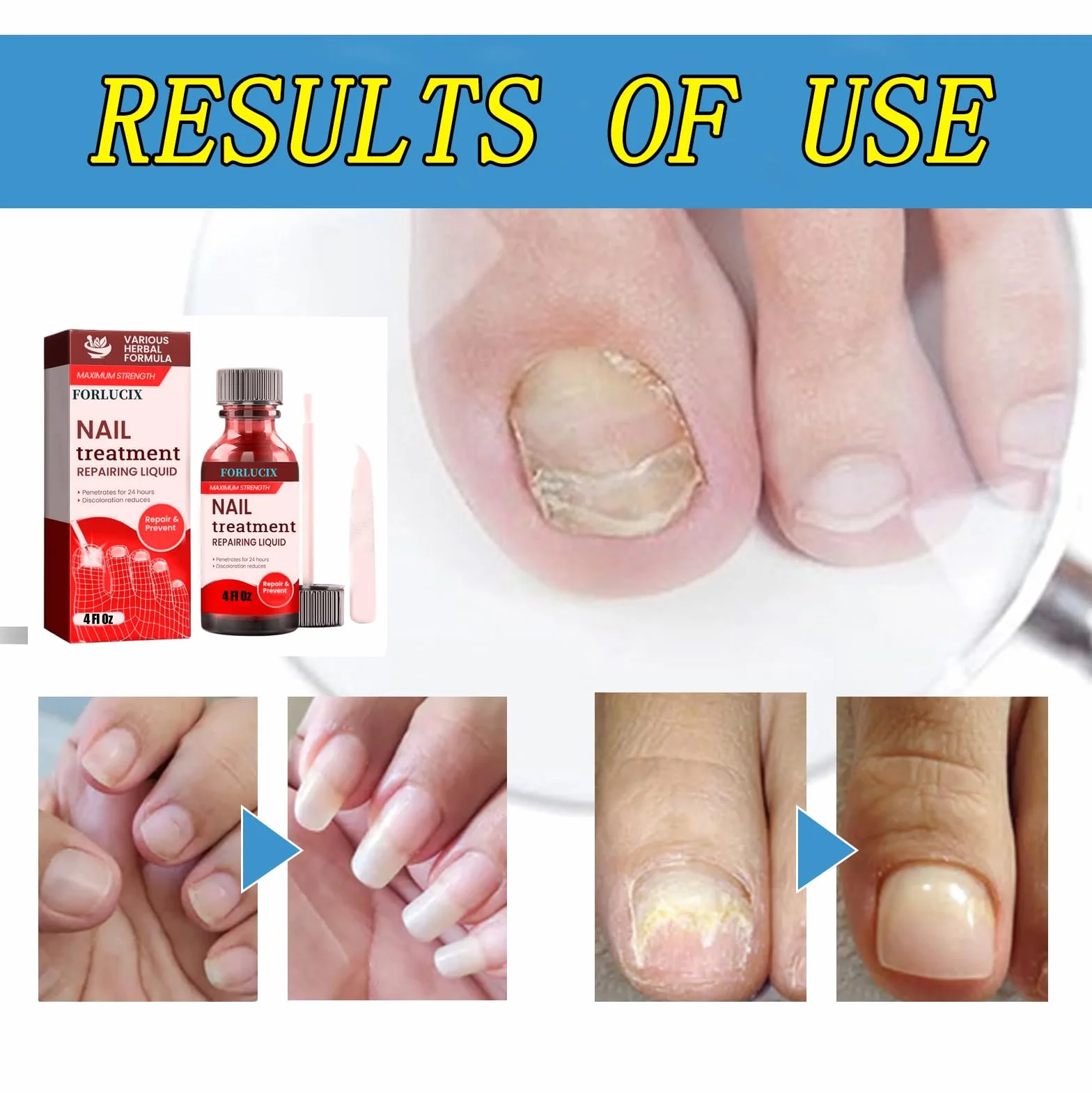 Extra Strength,4 Fl Oz(Pack of 1),Red