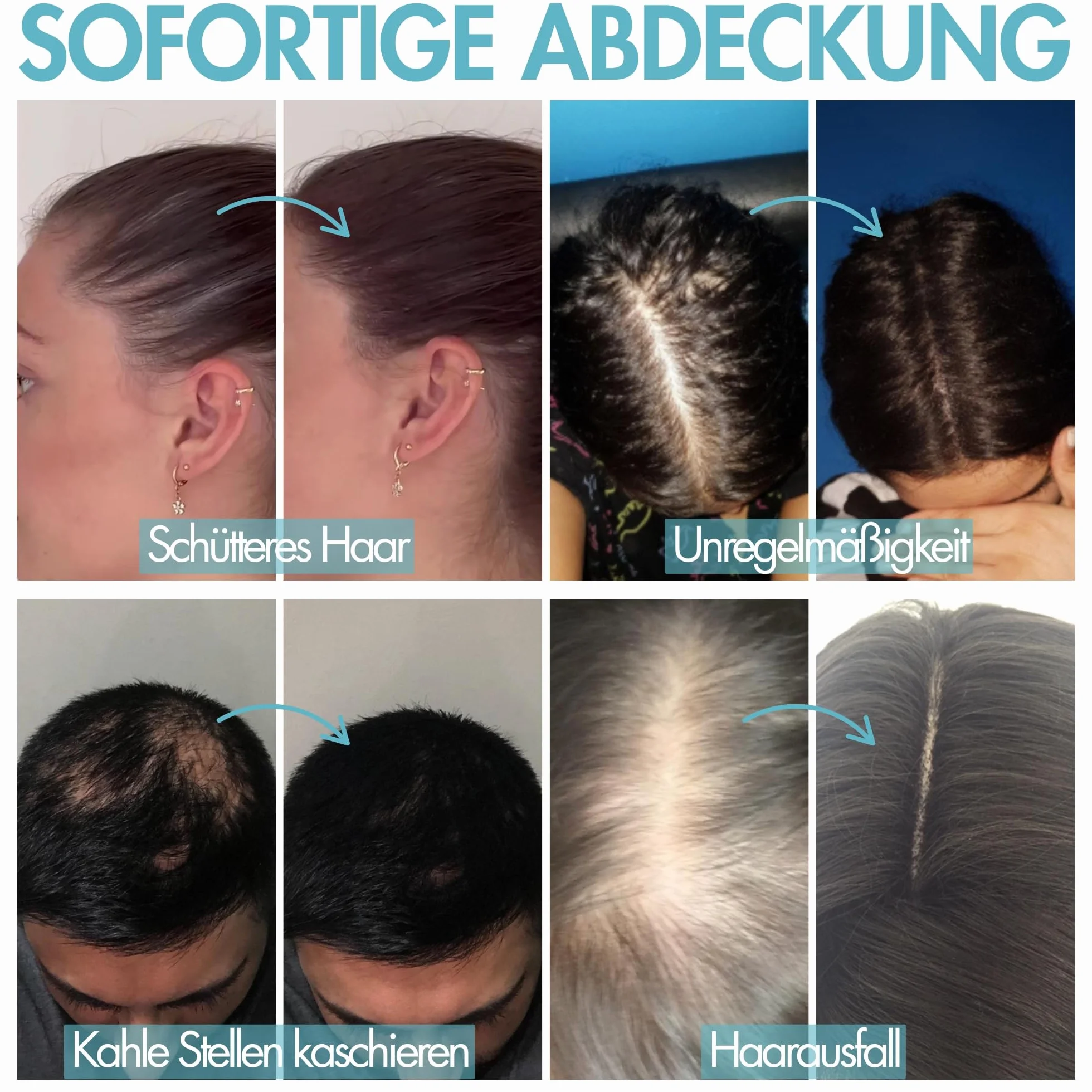 Hair Genetics Włókna włosów, na wypadanie i przerzedzanie włosów, 22 g, ciemnobrązowe