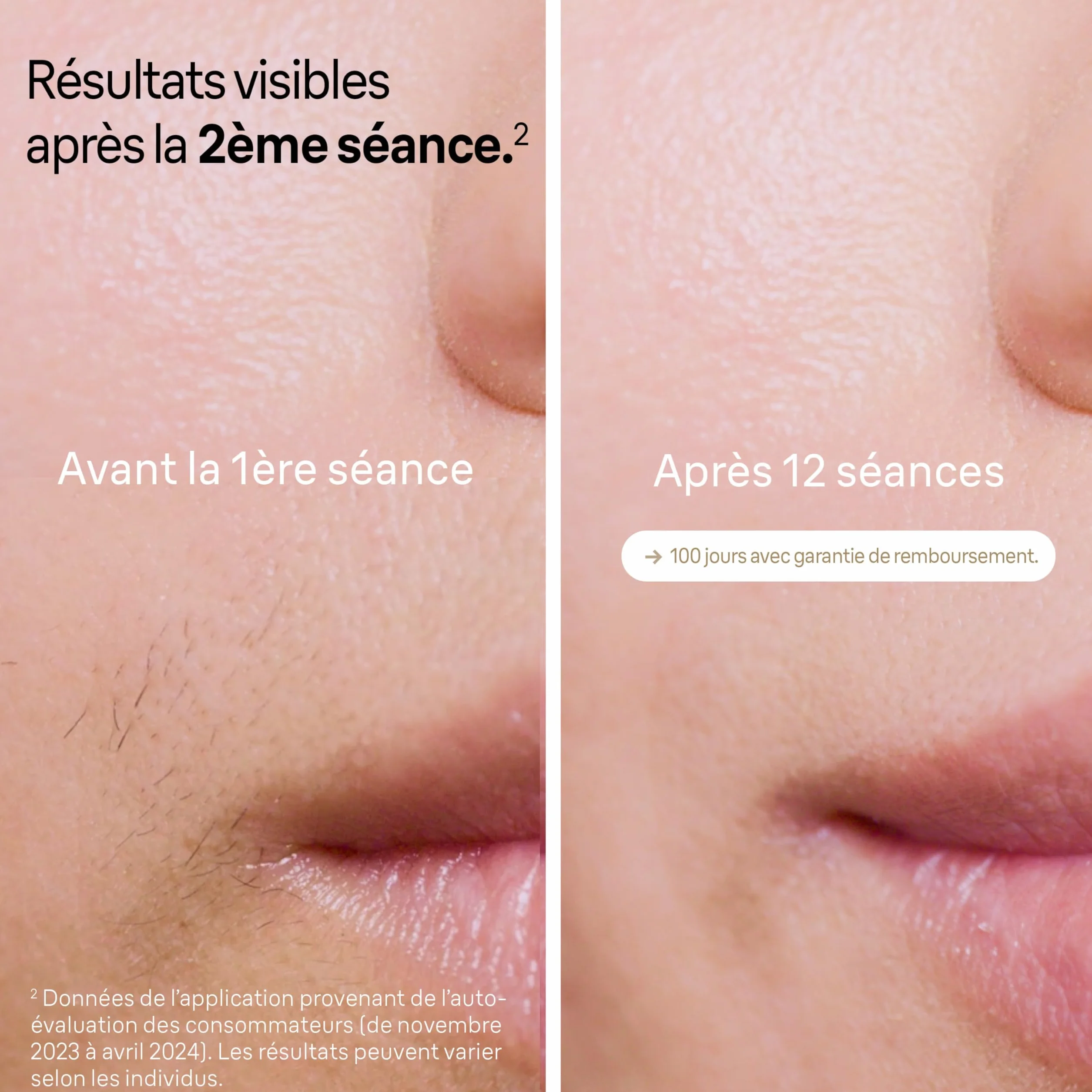 Braun IPL Silk·expert Pro 5 PL5262, depilator do usuwania włosów, 3 nasadki, golarka Venus