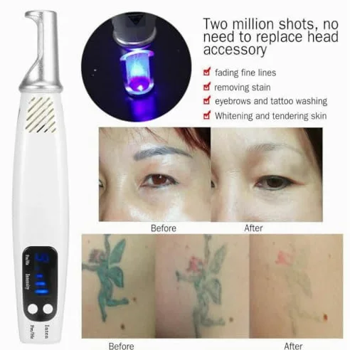 Pióro do usuwania znaczników skórnych, pikosekundowy, laserowy długopis, terapia światłem, maszyna do usuwania tatuaży, niebieskiego/czerwonego światła, pigmentu, usuwanie blizn, piegów, usuwanie
