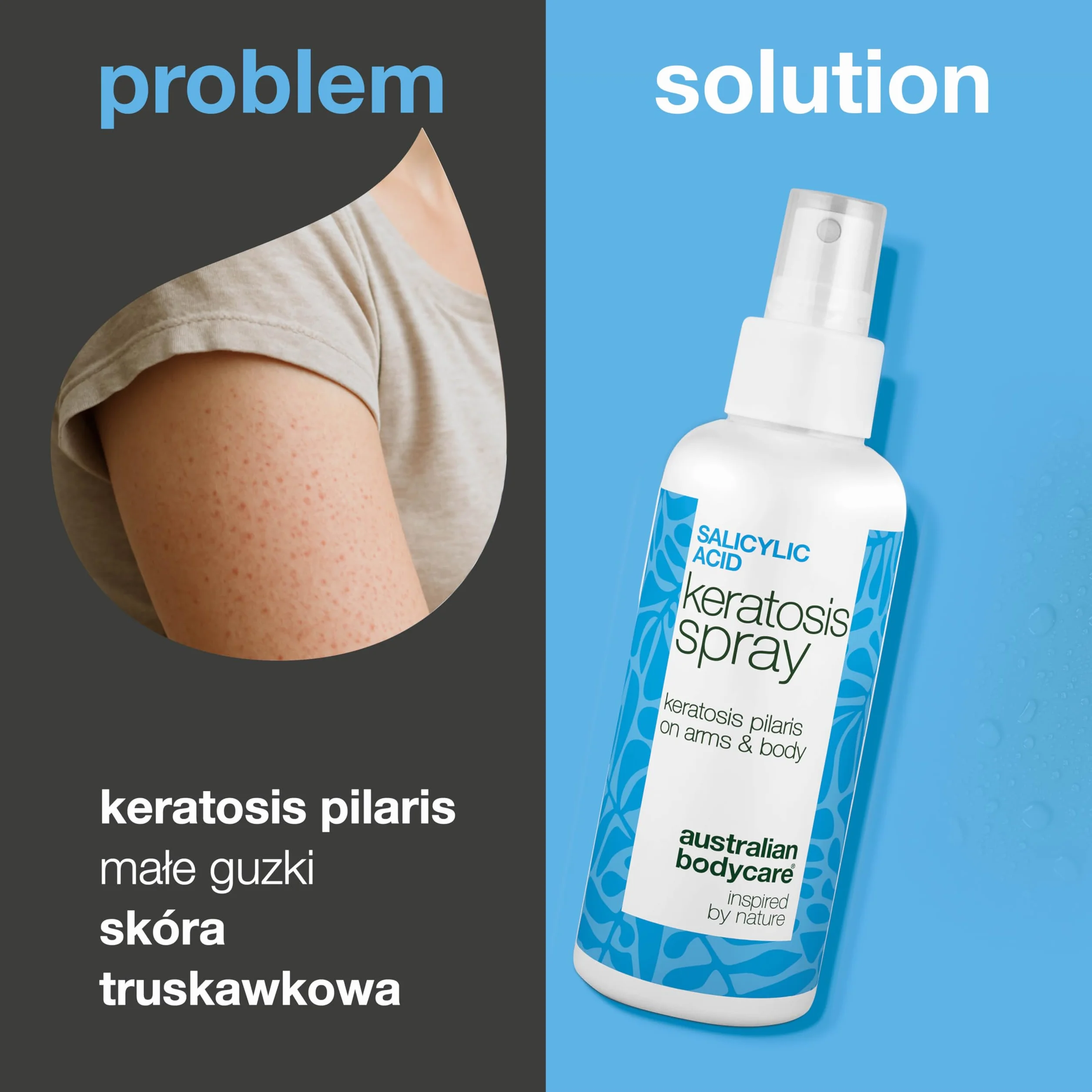 Spray na Keratosis Pilaris – usuwa rogowacenie mieszkowe, gęsią skórkę i szorstką skórę z kwasem salicylowym, glikolowym, pantenolem i gliceryną