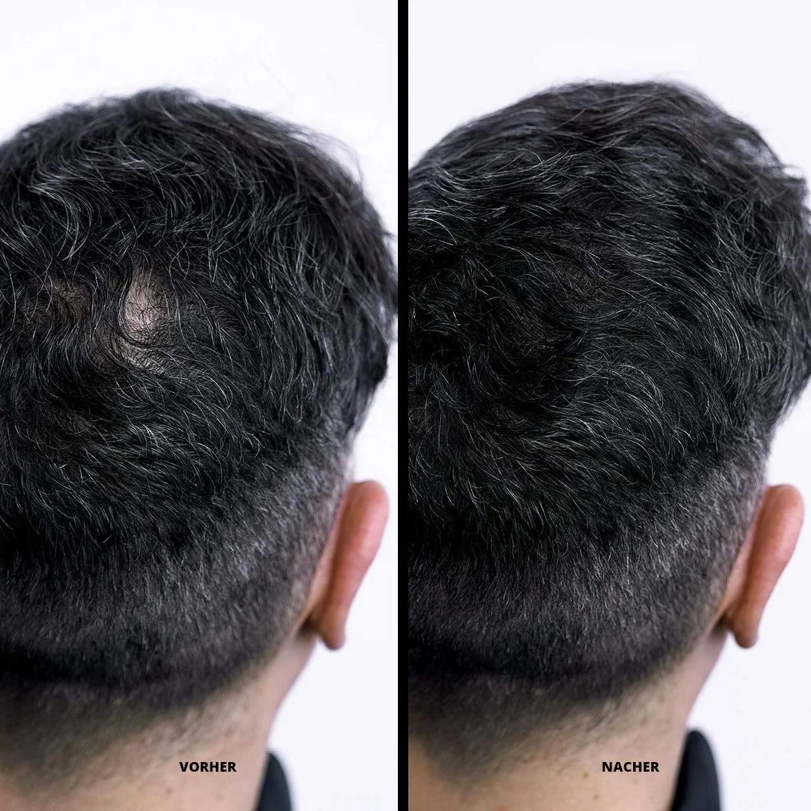 Super Million Hair - odprowadzające włókna do włosów rozjaśnionych, wypadanie włosów, 25g, średni blond (45)