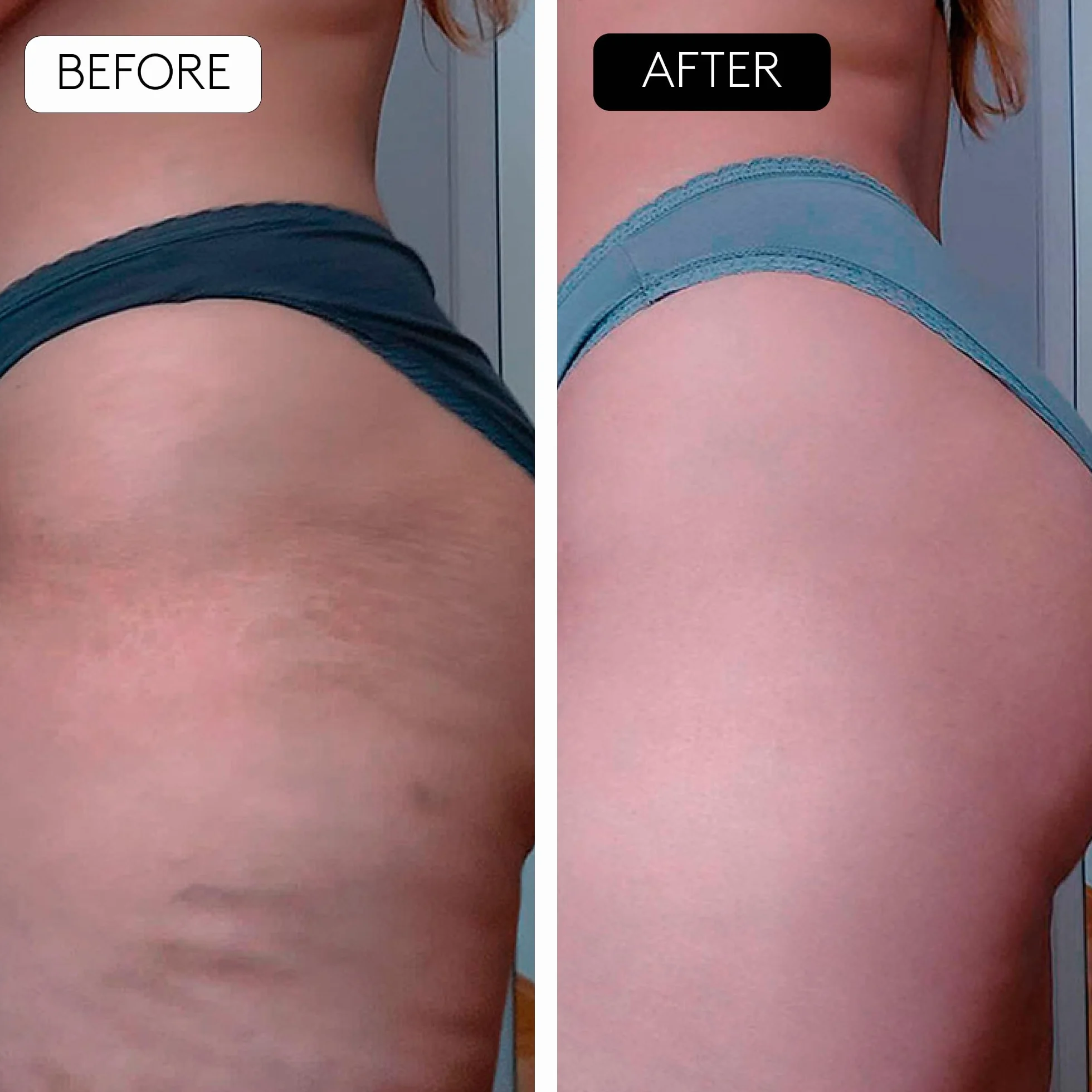 COCUNAT - Body Power - Anti-Cellulite and Slimming - Combats Cellulite - Redefines Silhouette | 150 ml + 125 ml