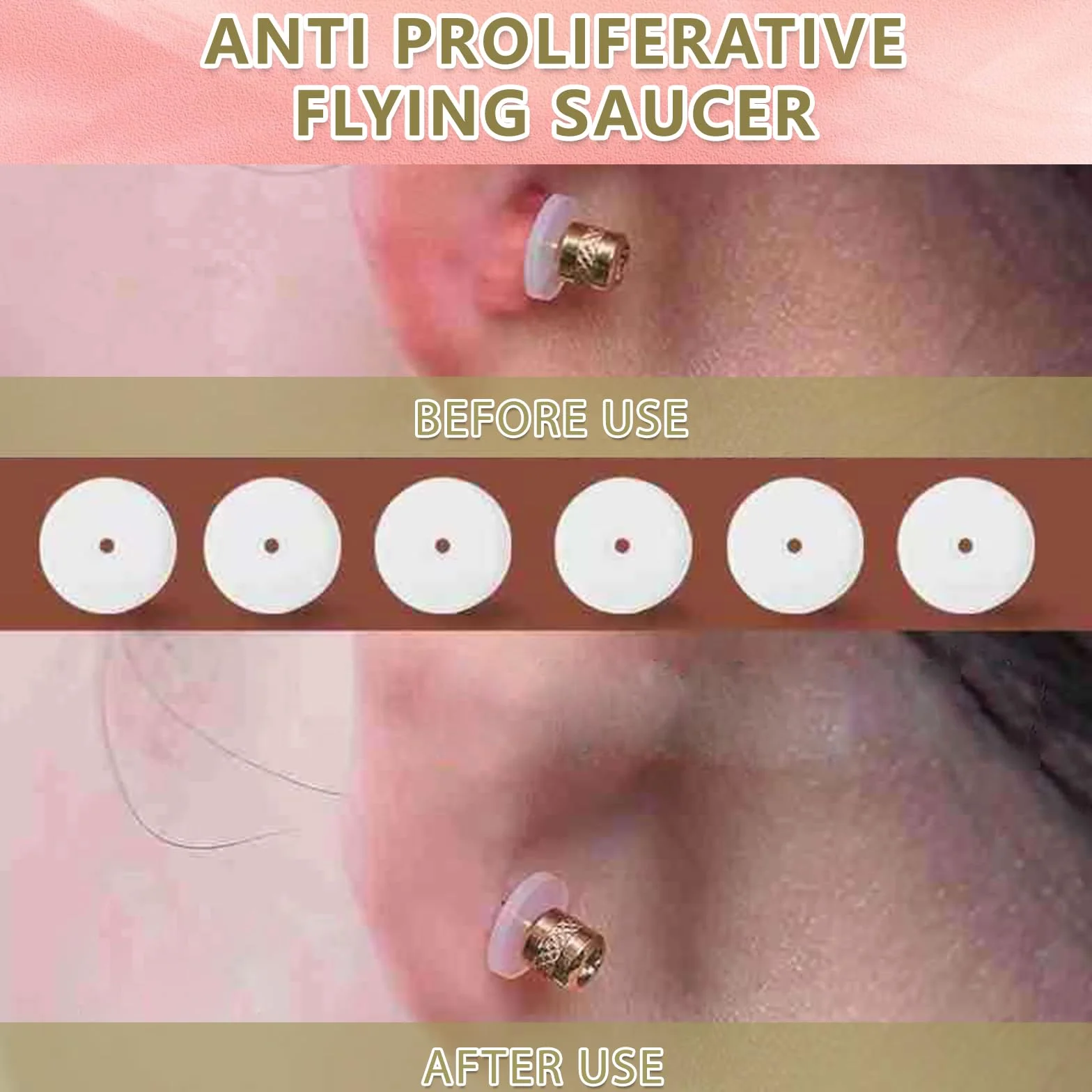 60 szt. Krążek do piercingu Anti Wildfleisch, przezroczysta płytka do piercingu, krążek Keloid do piercingu na grudkę, kolczyki, poduszki do uszu z plastikową skrzynką, 6 rozmiarów