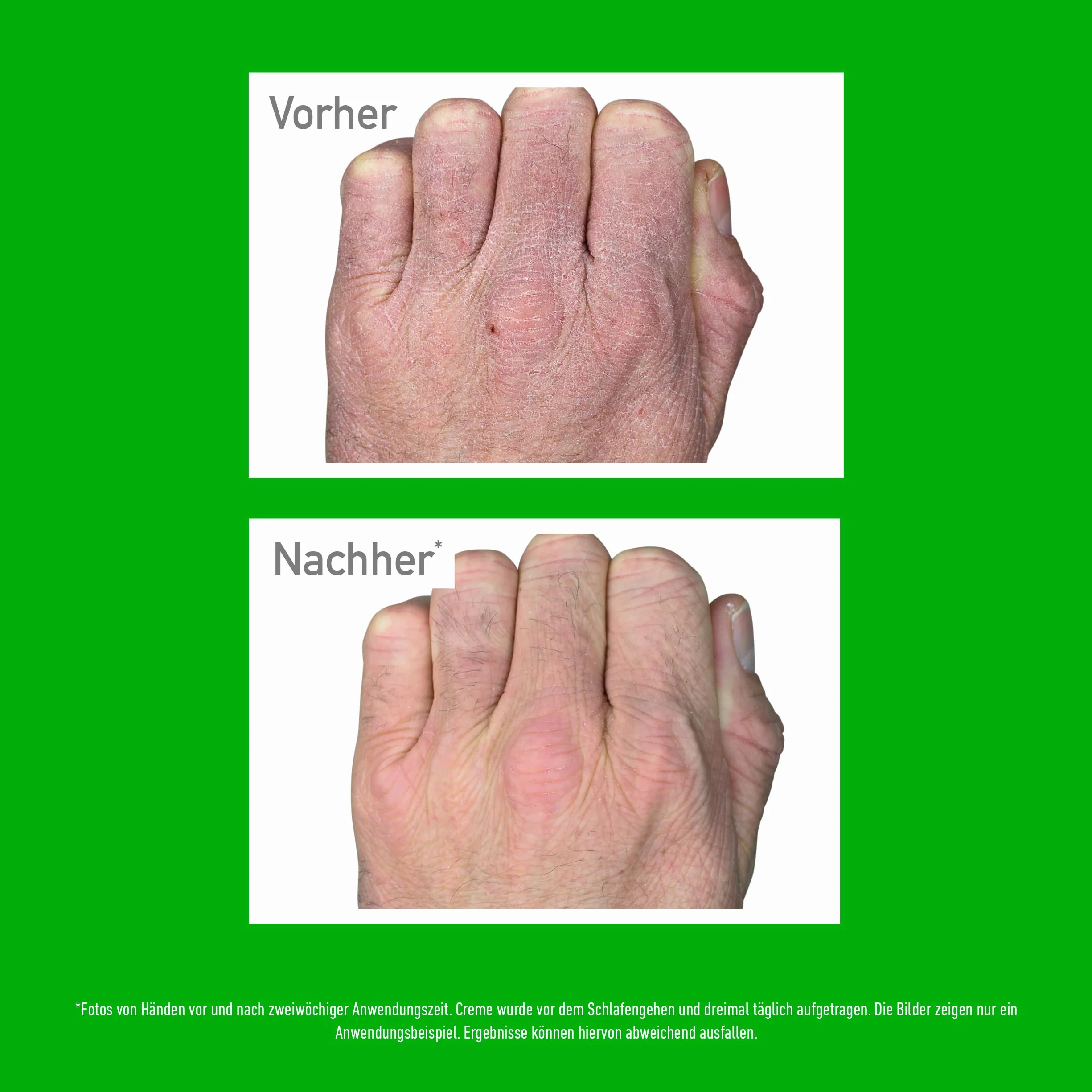 O'Keeffe's Working Hands, 96 g tygiel – krem do rąk do bardzo suchych, popękanych dłoni | natychmiast zwiększa zawartość wilgoci, tworzy warstwę ochronną i zapobiega utracie wilgoci