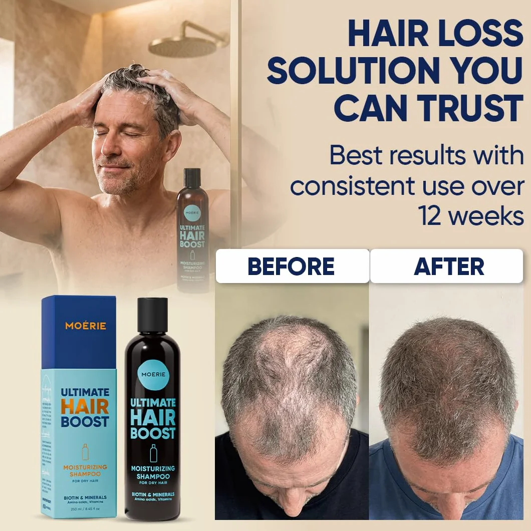 Moerie Ultimate Hair Growth Shampoo – dla dłuższych, grubszych, pełnych włosów – wegańskie, przyjazne dla skóry – bez parabenów i silikonu – wszystkie rodzaje włosów – odwrotne wypadanie włosów