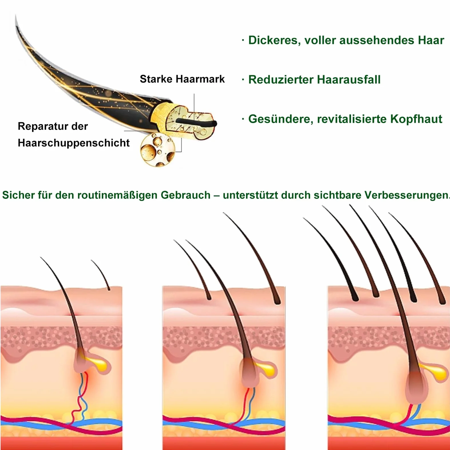 Microneedle Hair Regrowth System – system odrastania włosów, mikroinfuzja serum na wzrost włosów, wzmacnia cebulki włosów, wspomaga wzrost włosów, zapobiega wypadaniu włosów dla mężczyzn i kobiet