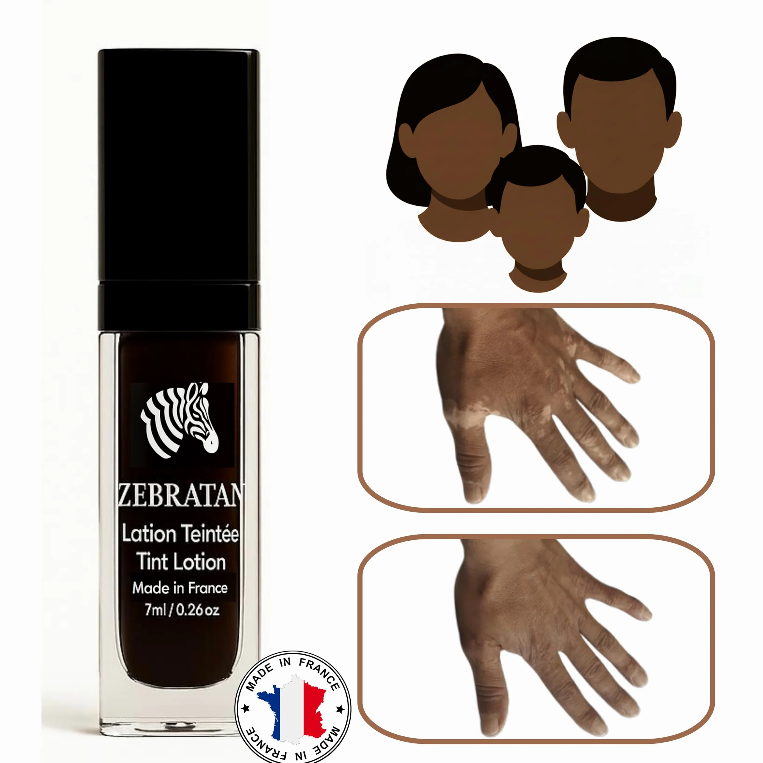 Lotion do makijażu bielactwa 7 ml – Maskuje białe plamy – Naturalny kamuflaż, wegański, głęboki brązowy odcień