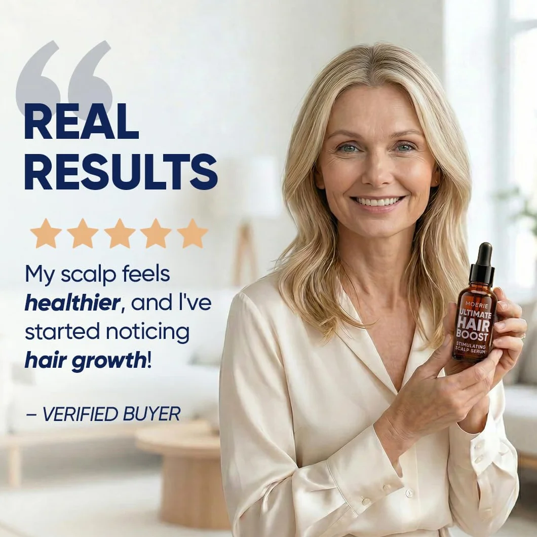 MOERIE Hair Growth Serum 50 ml – przyspiesza porost włosów i zapobiega wypadaniu włosów u kobiet – serum na porost włosów na skórze głowy – serum przeciw wypadaniu włosów (zestaw 2 szt.)