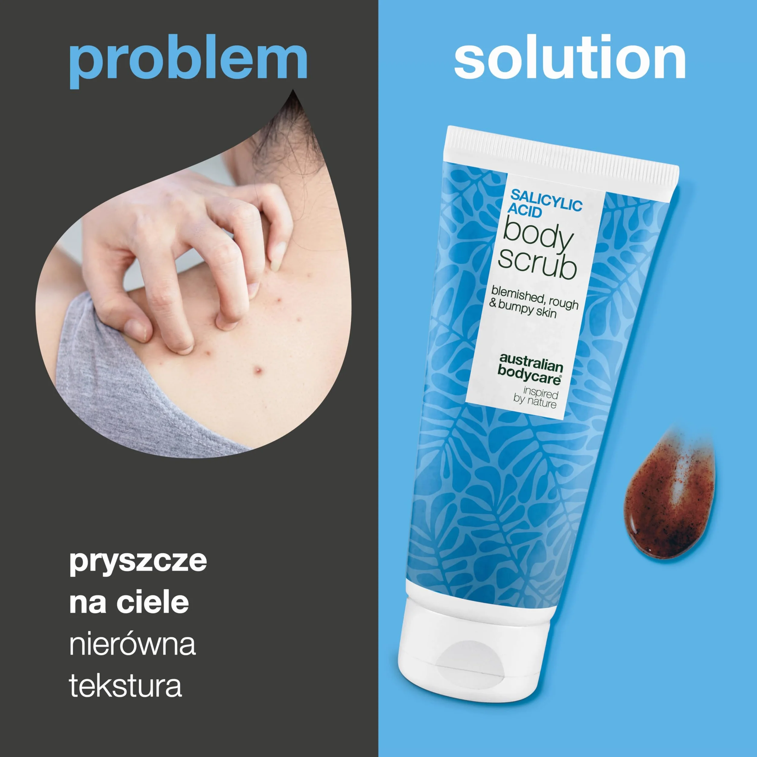 Peeling do ciała z kwasem salicylowym na trądzik, zaskórniki i niedoskonałości na plecach, pośladkach i ciele – usuwa martwy naskórek dzięki kwasom salicylowym (BHA) i glikolowym (AHA) oraz gliceryną