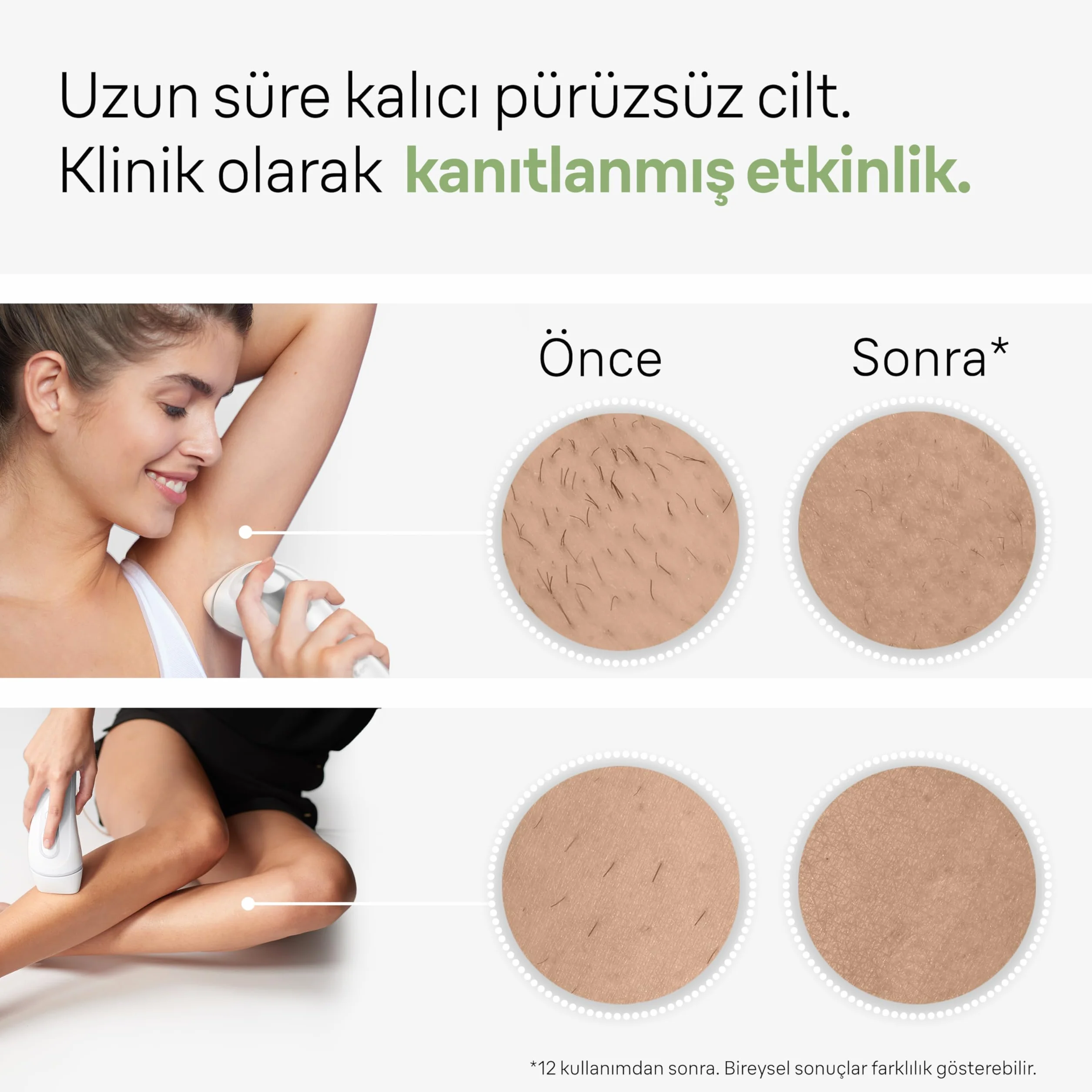 Braun Silk-expert Pro 3 Pl3139 Ipl Epilator One Size