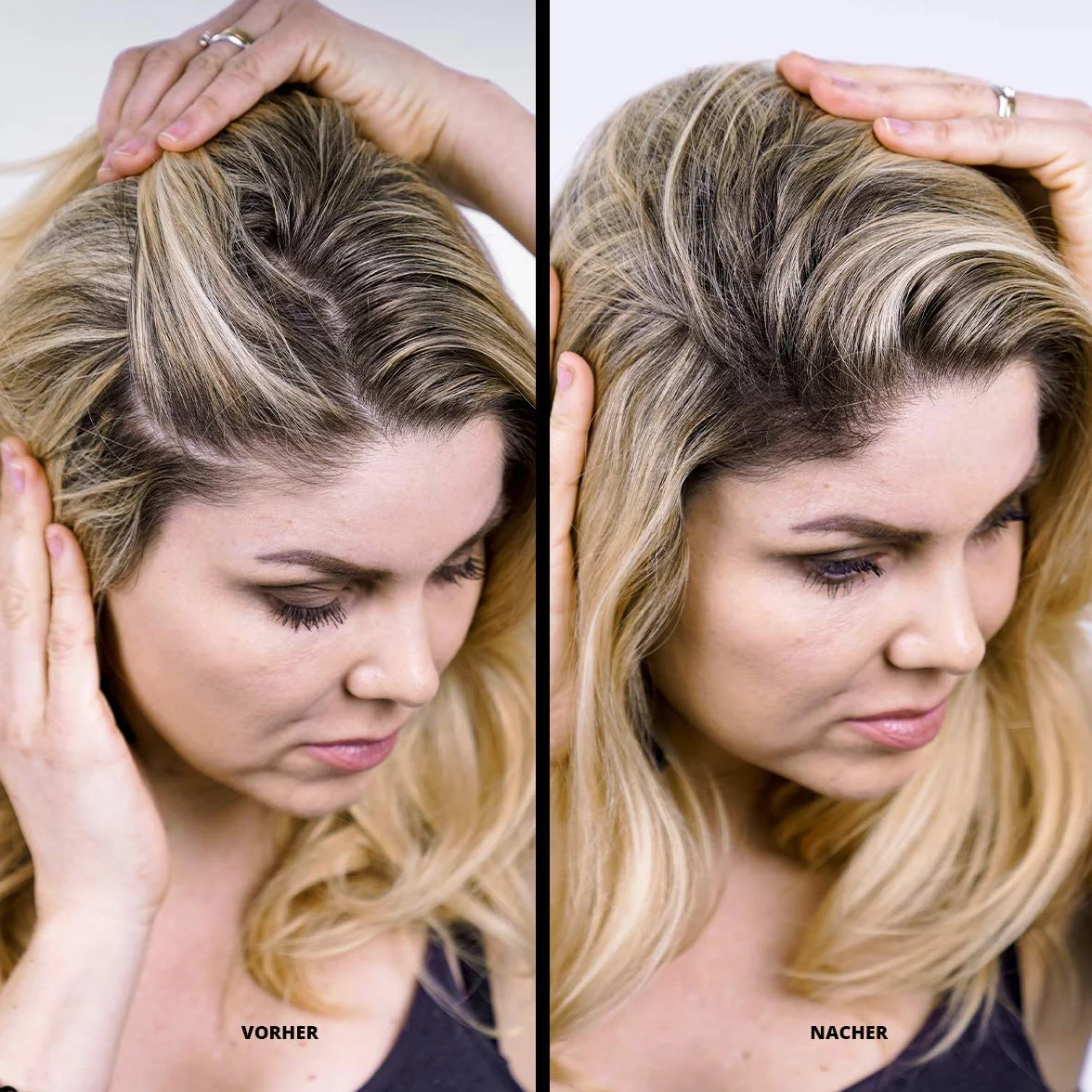 Super Million Hair - odprowadzające włókna do włosów rozjaśnionych, wypadanie włosów, 25g, średni blond (45)