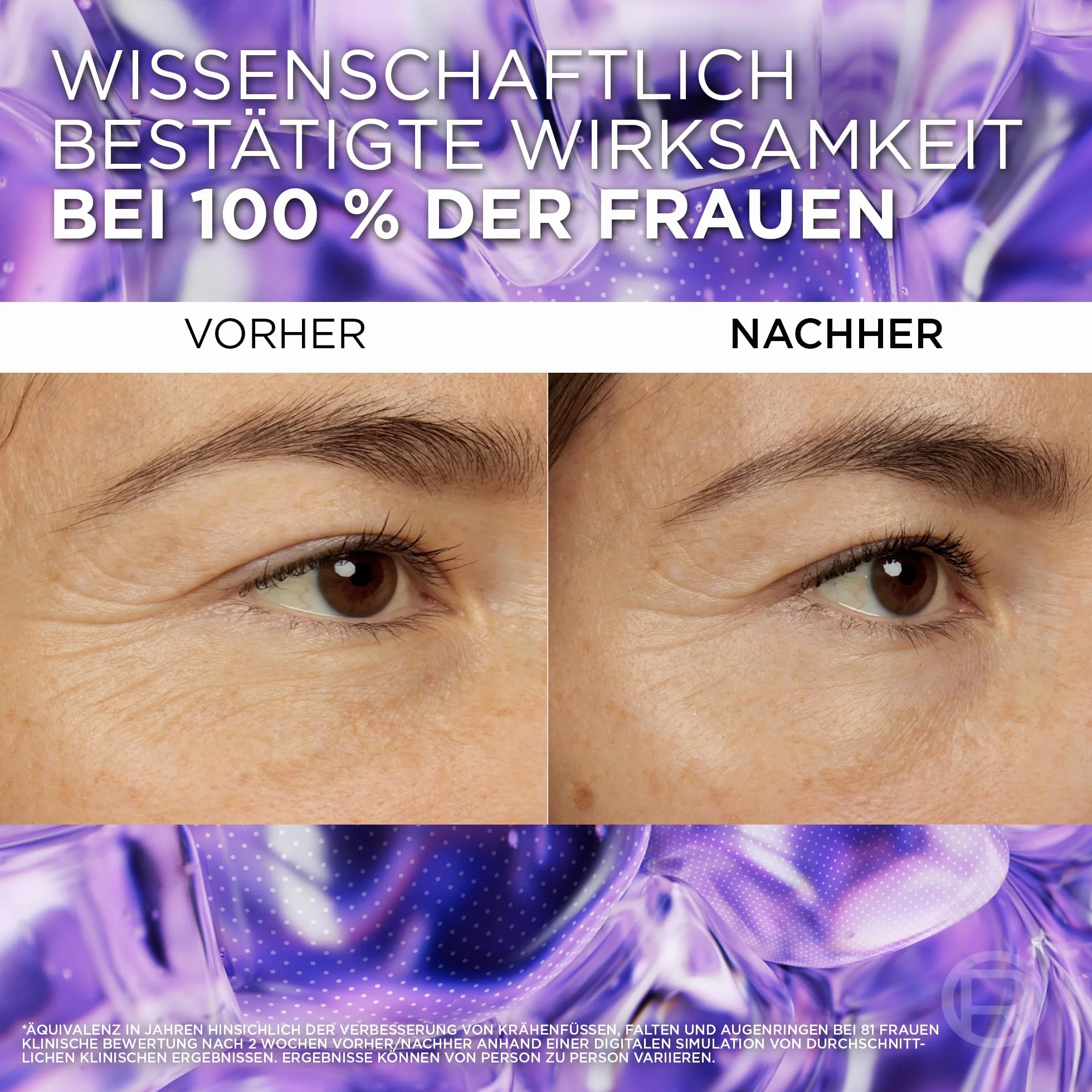 L'Oréal Paris Serum do oczu dla kobiet: zapewnia wyściełaną okolicę oczu i mniej ciemnych cieni pod oczami, 2,5% [kwas hialuronowy + kofeina], Revitalift Filler, 1 x 20 ml