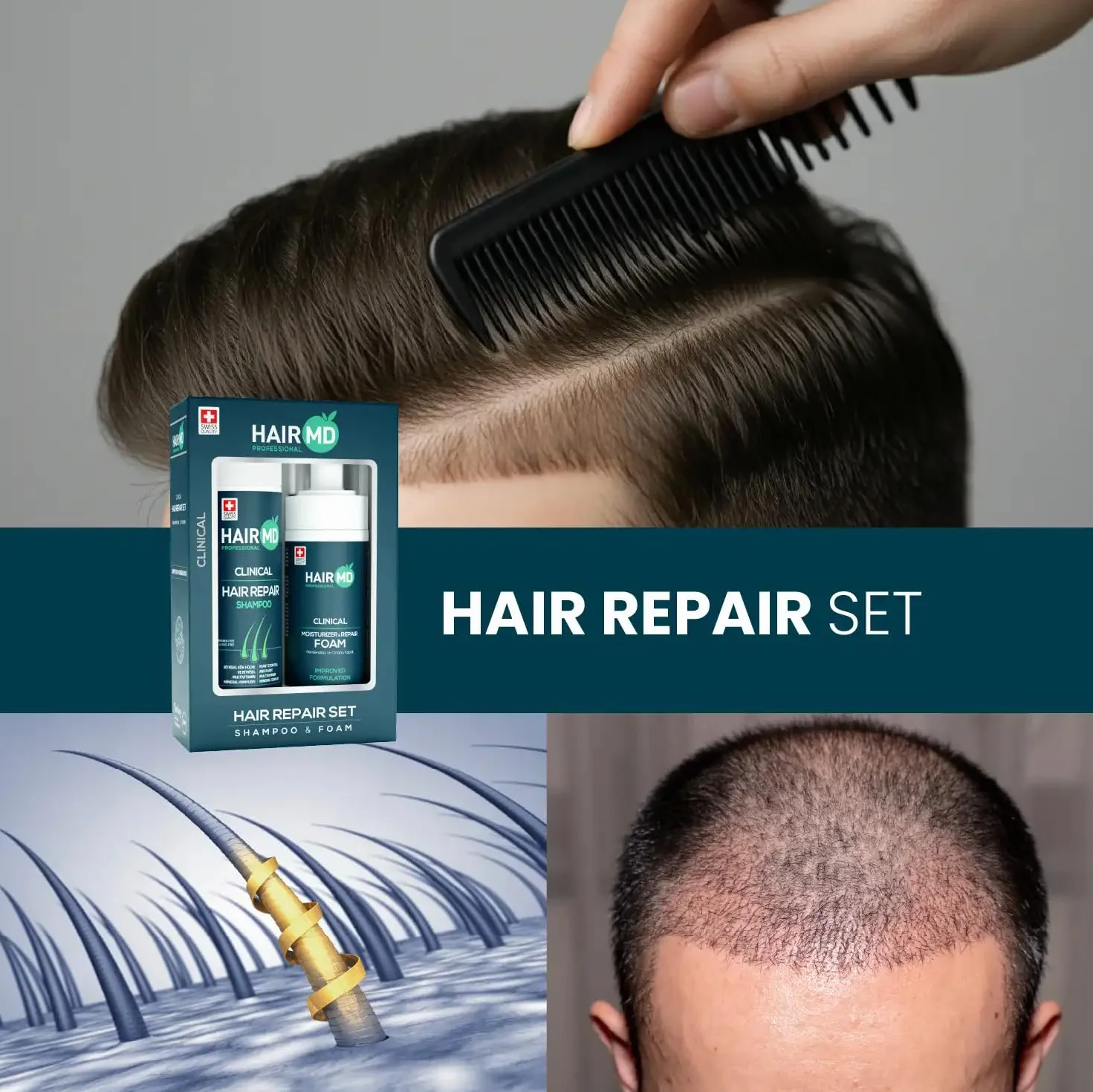 HairMD Zestaw szamponów i pianki na porost włosów z szamponem regenerującym 250 ml i pianką naprawczą 150 ml – bogaty w biotynę, keratynę, palmetto, odpowiedni do wszystkich rodzajów włosów