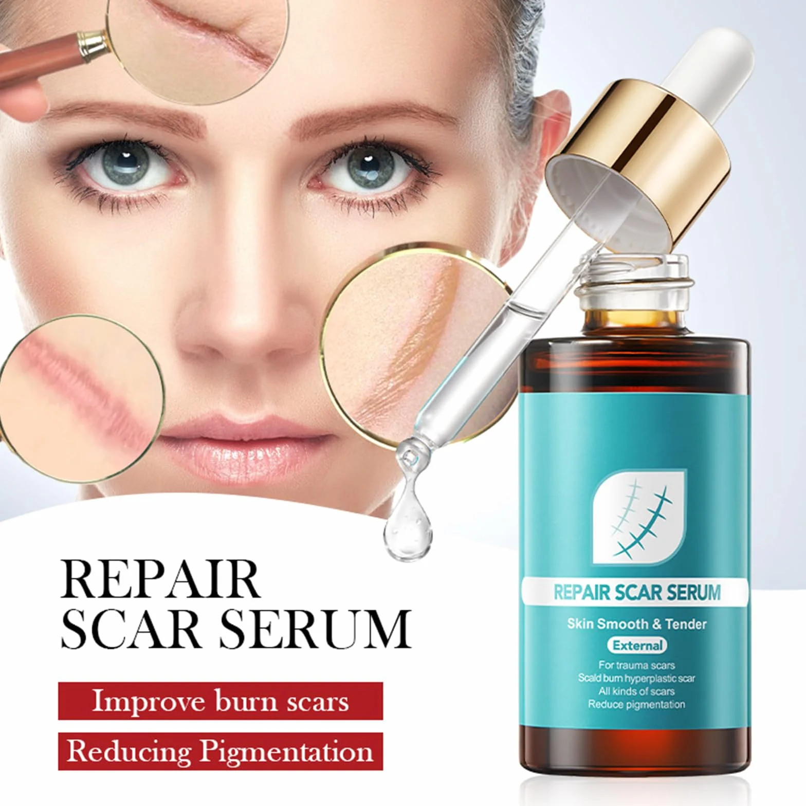 Serum do blizn, serum na blizny, serum na rozstępy, łagodniejsze blizny, bardziej elastyczne i mniej widoczne, stare i nowe blizny, usuwanie blizn