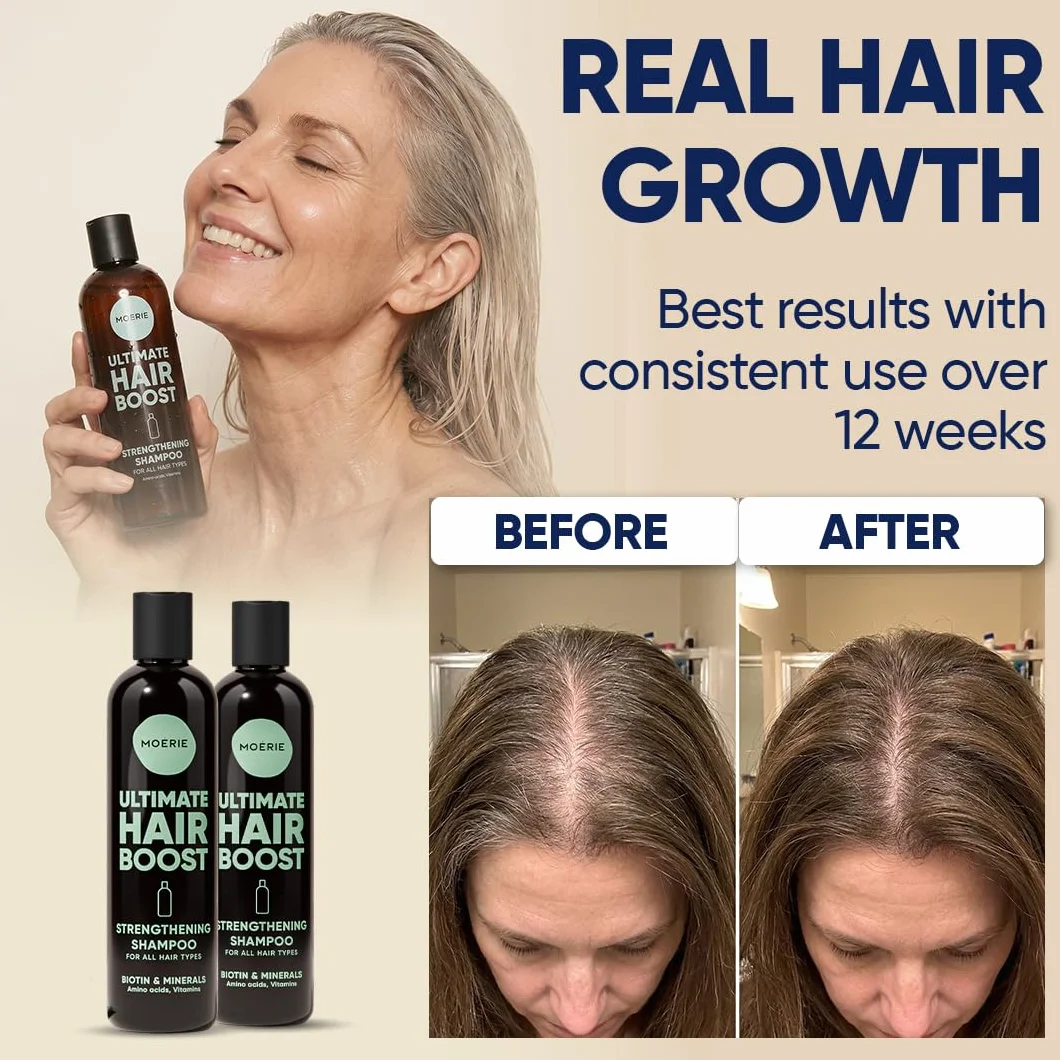 Moerie Ultimate Hair Growth Shampoo – dla dłuższych, grubszych, pełnych włosów, wegańskie, bez parabenów i silikonu