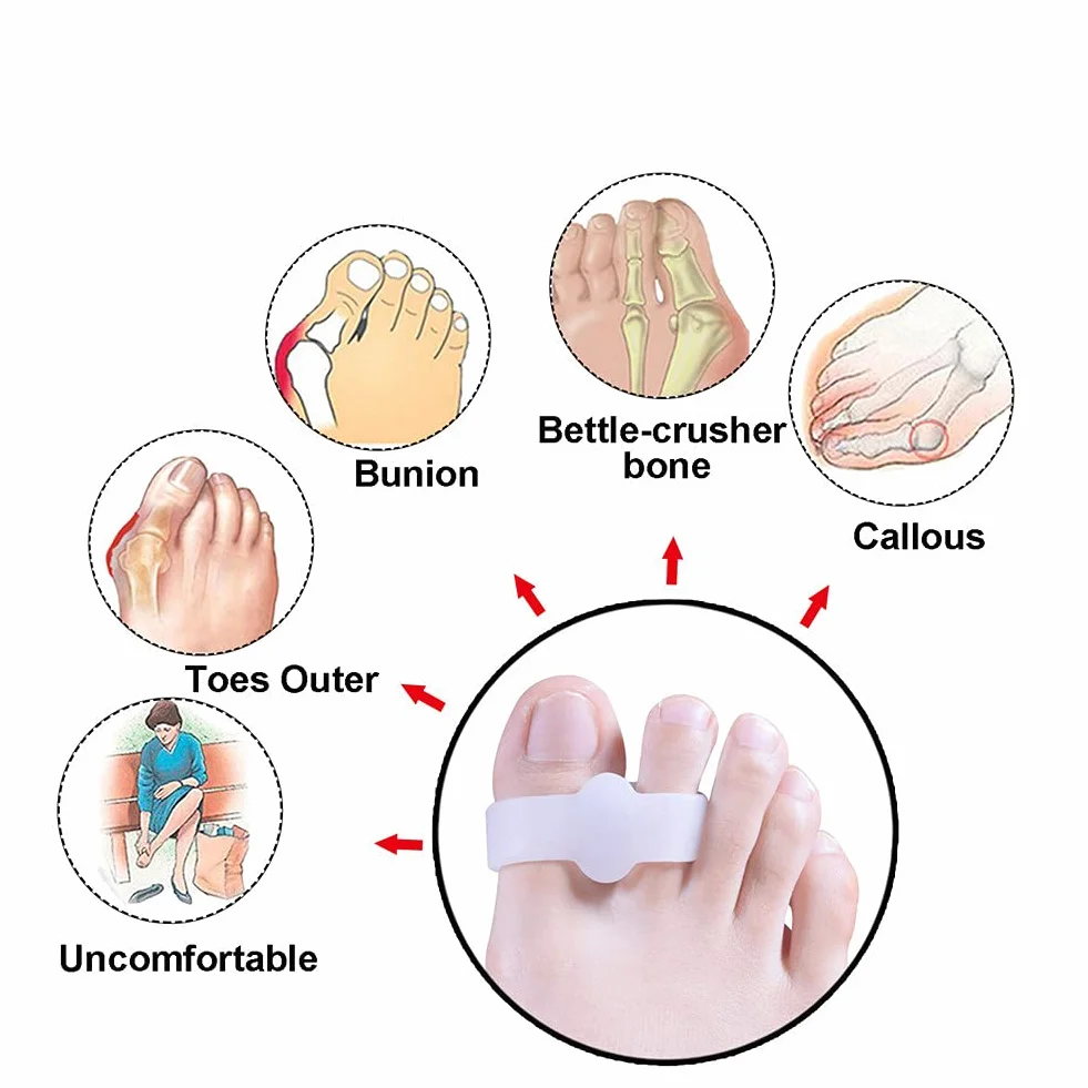 4 silikonowe separatory do palców Hallux Valgus, młotkórek, kurzyste oczy, duży palec + neb