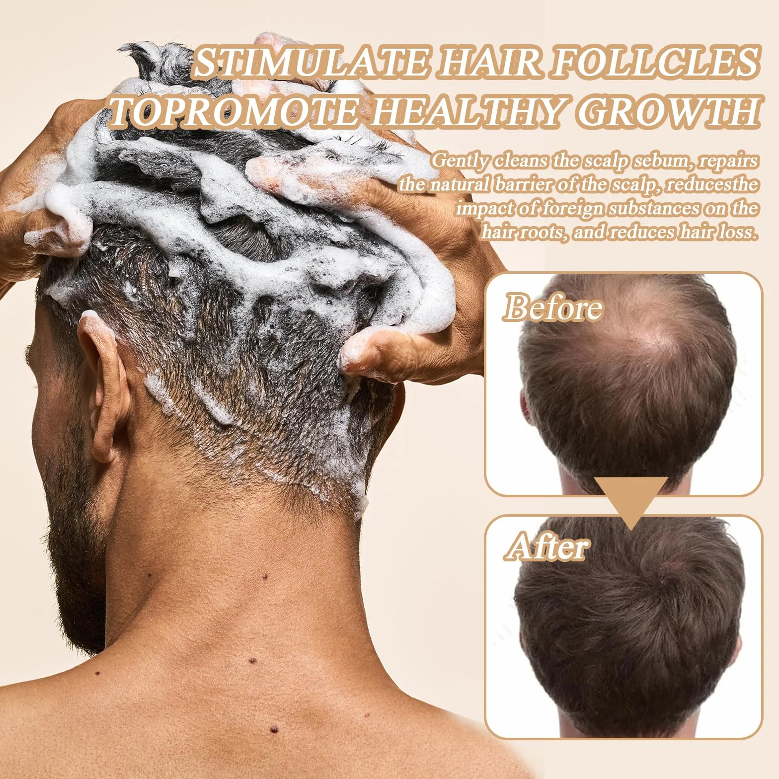 Root Activating Szampon 2 sztuki Ginger Black Hair Growth Shampoo 2024 New Root Activator Szampon nadaje się do poprawy objętości i tekstury włosów