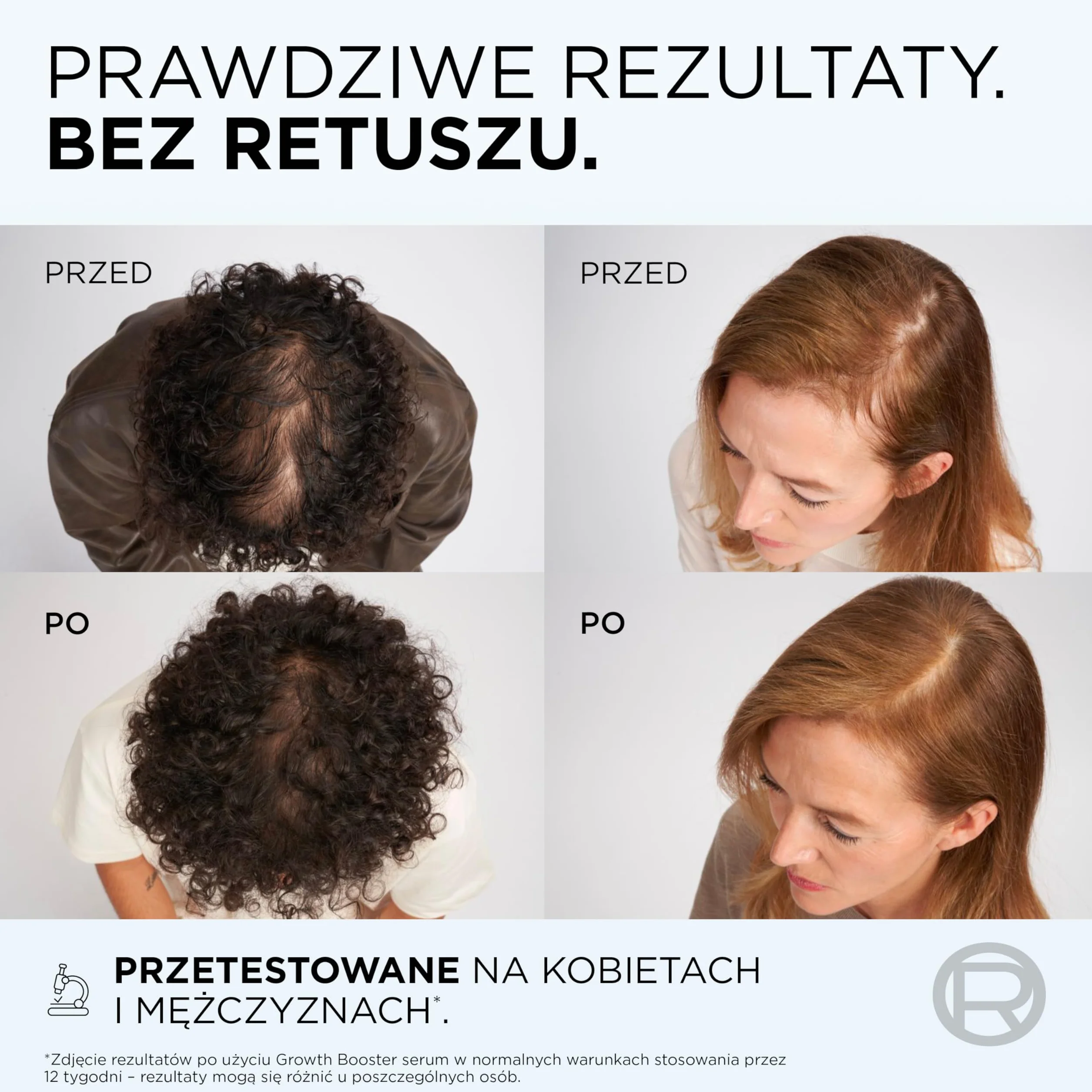 L'Oreal Paris Elseve Growth Booster serum do skóry głowy przeciw wypadaniu włosów 102 ml