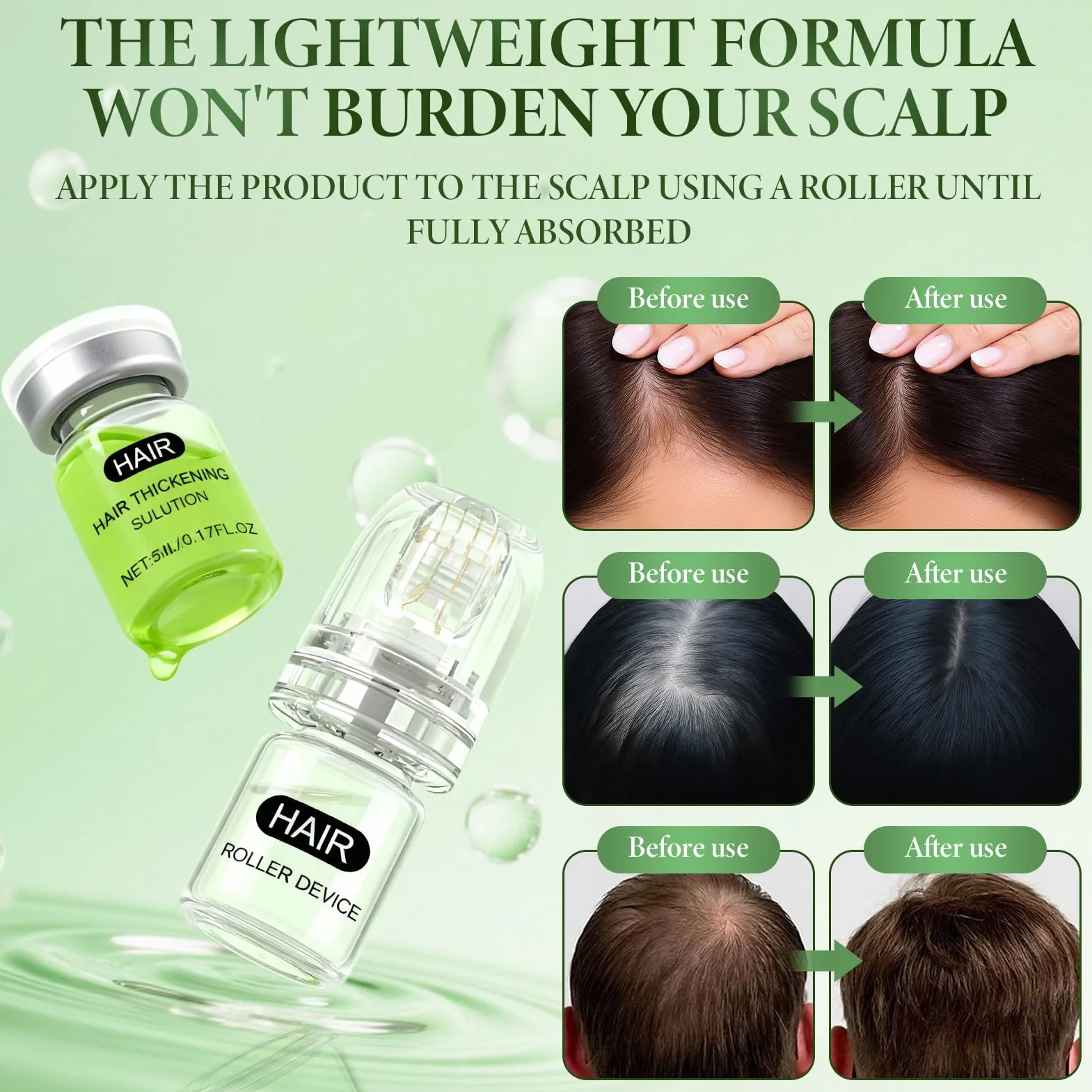 Alpha Infuse Hair Serum do Wzrostu Włosów z Infuzją Microneedle
