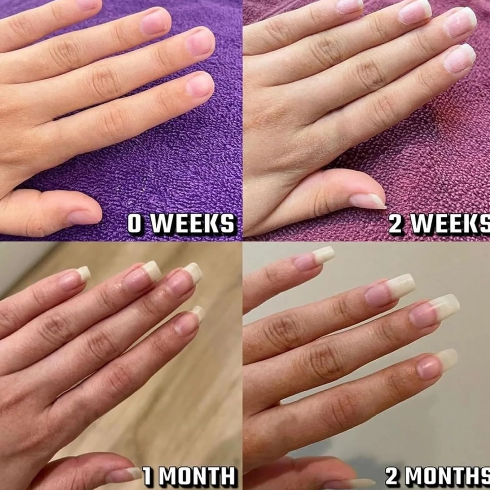 Lyra Cosmetic Nails, Olejek do skórek paznokci, Radiant Nail Growth Oil, Kosmetyczne serum nawilżające, wzmacniające i rozjaśniające pielęgnację paznokci(4pcs)