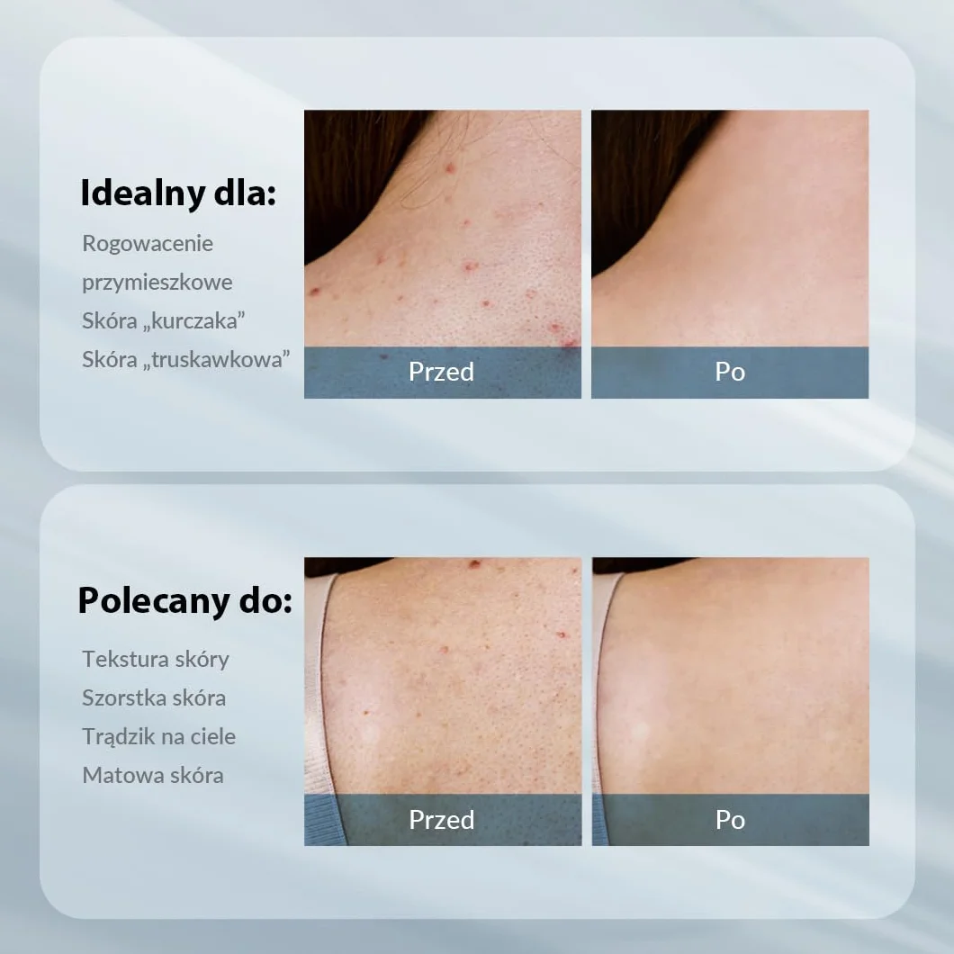 AHA Body Lotion Glicolic ACID 12% 300g Peeling Korean Skincare