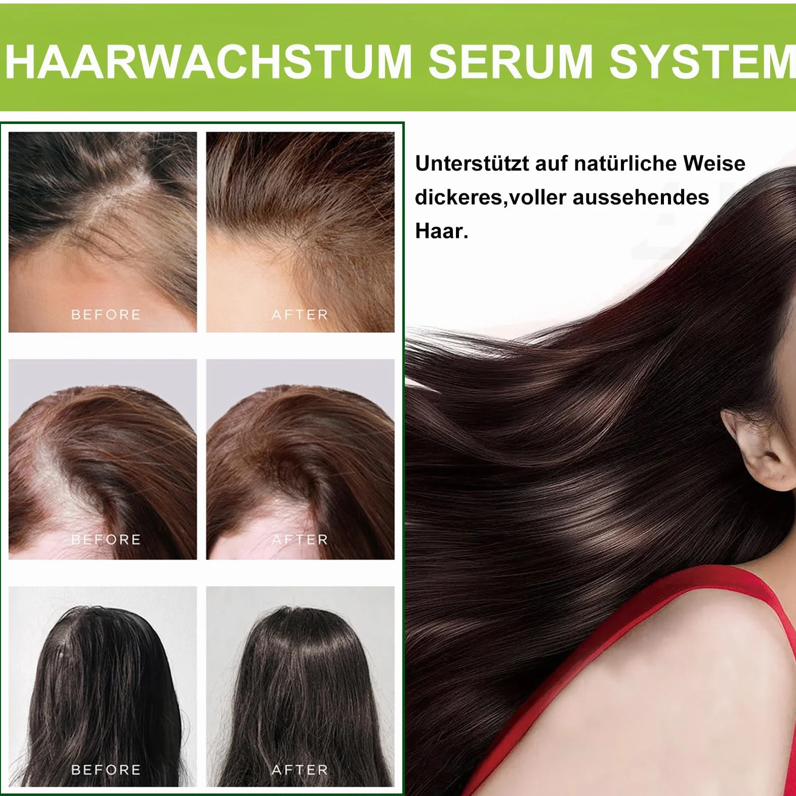 Microneedle Hair Regrowth System – system odrastania włosów, mikroinfuzja serum na wzrost włosów, wzmacnia cebulki włosów, wspomaga wzrost włosów, zapobiega wypadaniu włosów dla mężczyzn i kobiet