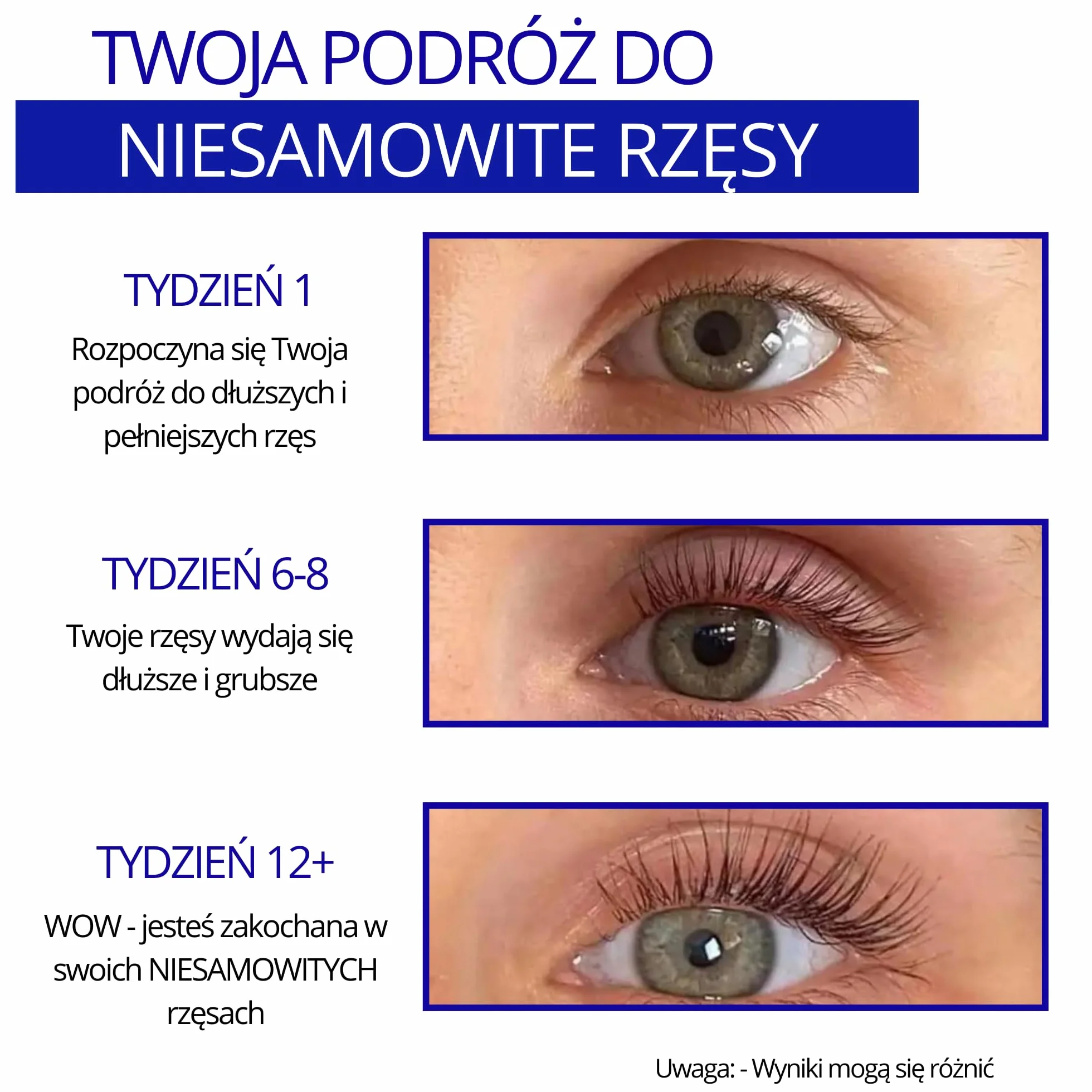 JAK WIDZIANY W VOGUE Spectaculash Advanced Serum do wzrostu rzęs, Lash Enhancer, Odżywka, Rosną długie i gęste rzęsy Naturalnie od DERMAWORKS (XL - 8ml)