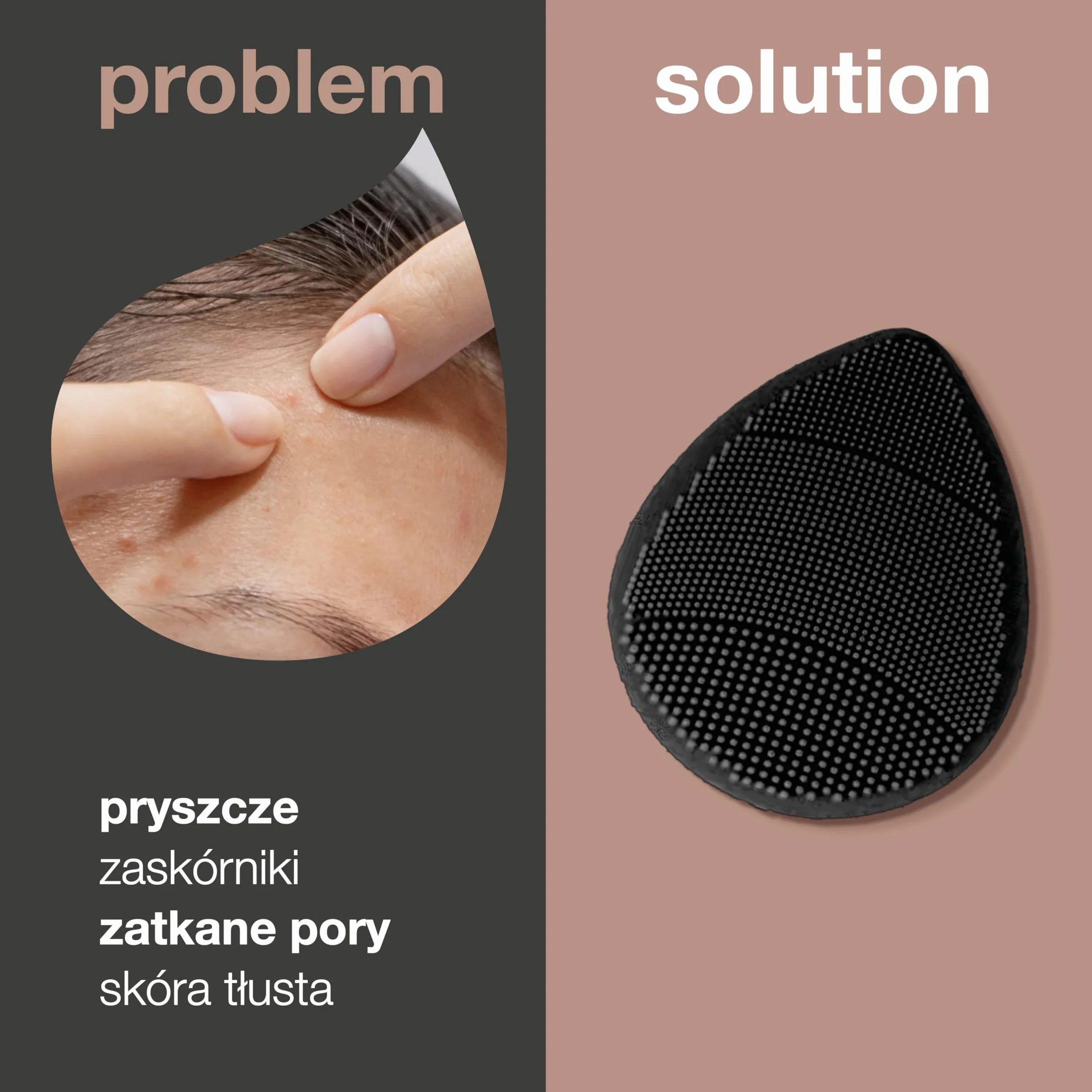 Australian Bodycare szczotka do twarzy do codziennego mycia i peelingu w przypadku trądziku, wągrów i zanieczyszczonej skóry